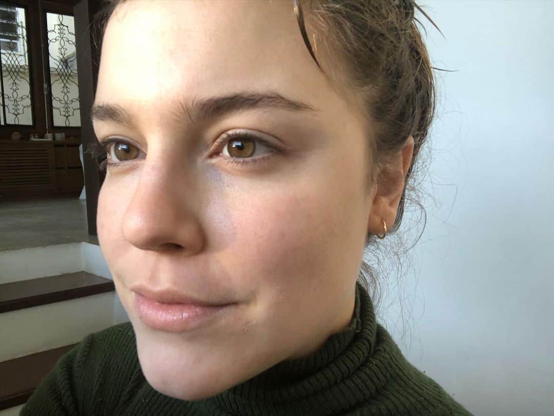 Alice Wegmannのインスタグラム：「TOUR DA PELE  oi xentê! esse carrossel é primeiro um depois (agora) e um antes - ambas as fota sem filtro. antes eu tava com um problema hormonal, minha pele estourou do ano passado pra cá e volta e meia me batia um desânimo e tipo oqueestaacontecendooo? não importava o que eu comia, o quanto eu me exercitava, ela simplesmente pipocava todinha. espinha é um treco que a mídia faz sempre questão de não mostrar, então a gente fica um pouco acuado às vezes de sair mostrando também. bem, eis aqui e agora a minha pele pra vocês! e mandar um beijo e lembrar que isso não pode impedir ninguém de viver a vida livremente e fazer tudo o que quiser fazer!!! mas a gente precisa cuidar, atentar e ter profissionais que auxiliem a gente né :) obrigada sempre ao dr @drcyrohirano, hoje depois de meses eu fui na clínica pra fazer uma limpeza e A GLÓRIAAA de não ter doído e de a Ana que me atendeu ter sido super fofa e querida. sigo me lambuzando de protetor solar e água e essas são as únicas dicas que eu vou dar pra vocês - o resto tudo vcs perguntam pra dermatologista 🤓♥️ é noix」