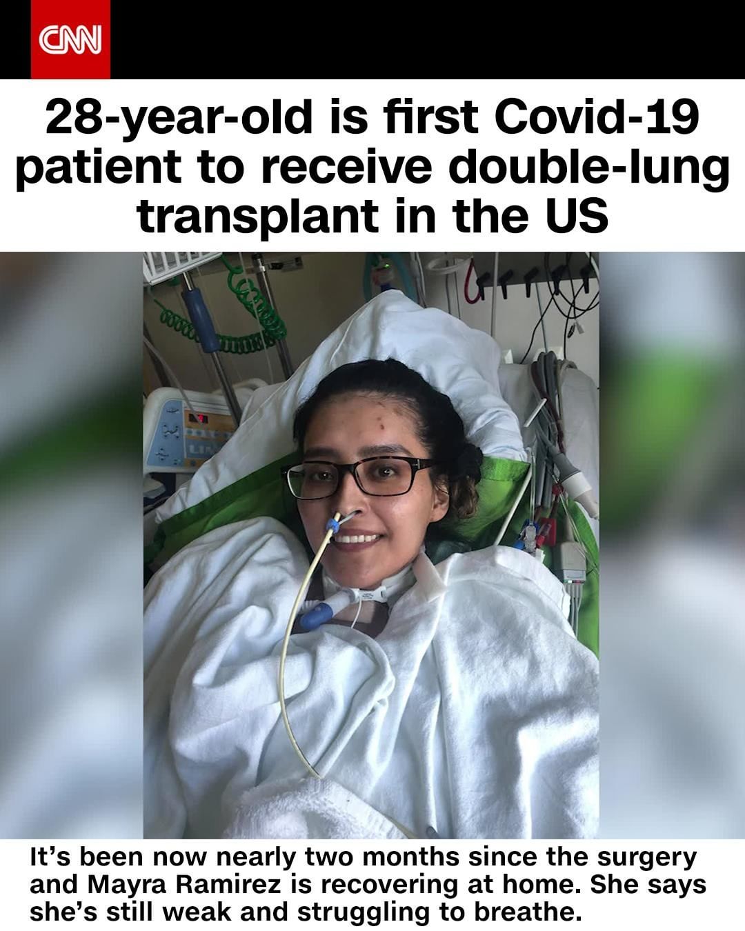 CNNさんのインスタグラム写真 - (CNNInstagram)「Mayra Ramirez says she was careful about following health precautions before she began to experience coronavirus symptoms and went to Northwestern Memorial Hospital's emergency room on April 26. Ramirez, who spent more than a month on a ventilator, is now the first known American to have undergone a double-lung transplant after a battle with Covid-19, according to the Chicago hospital. Dr. Ankit Bharat, the chief of Thoracic Surgery at Northwestern Medicine, says that without the transplant, she would not have lived. "This is not a hoax," Ramirez said. "This virus is real, it happened to me." (📸: Northwestern Medicine)」8月3日 23時01分 - cnn