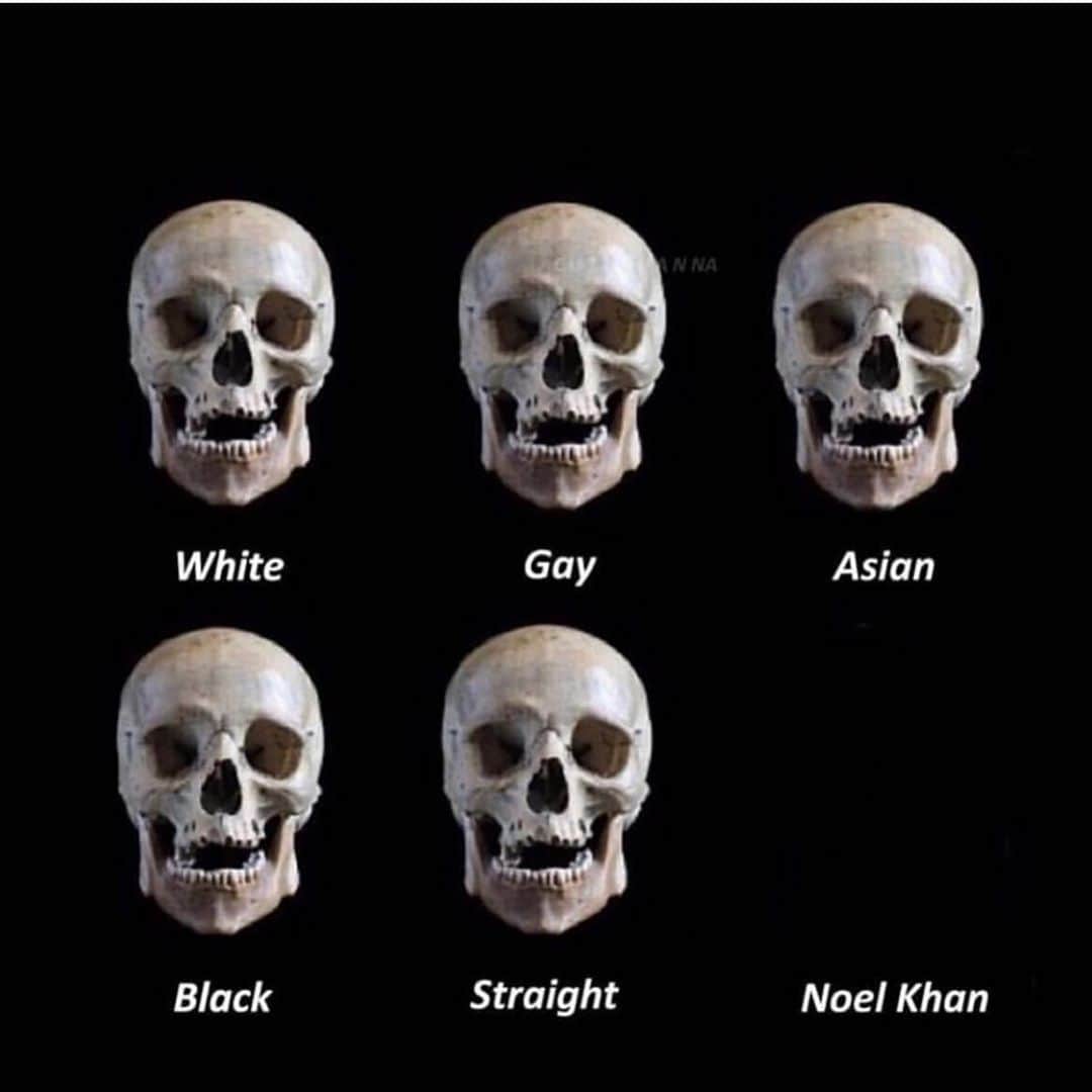 ブラント・ドーハティのインスタグラム：「Stop sending this to me 💀😂」