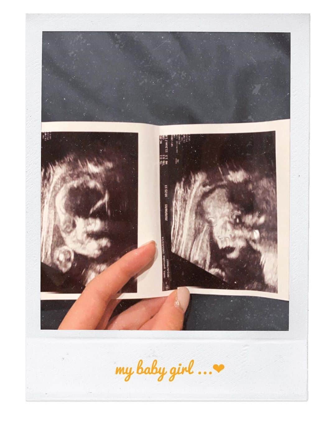 Yumaikaのインスタグラム：「my baby❤︎  性別は女の子💋  お顔 初めましてこんにちわ👶🏻 ボールペンで先生にお鼻と目 書いてもらったけど 分かるかなぁ？  エコーで お口 ぱくぱく動かしてました👶🏻  私と同じ 食いしん坊みたいです😋」