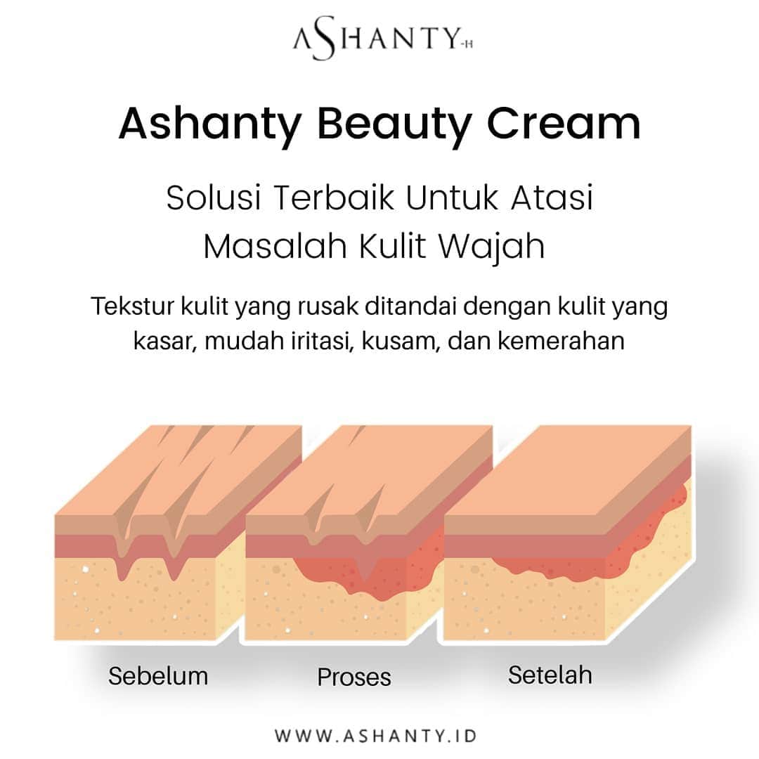 ASHANTY BEAUTY CREAM OFFICIALのインスタグラム：「Kenali kondisi wajah dan atasi masalah kulit wajah dengan cara yang tepat.   Ashanty Beauty Cream merupakan cream perawatan wajah terbaik yang dapat kamu gunakan untuk mengatasi masalah kulit pada wajahmu.  _____________________________ Informasi dan pemesanan  Ashanty Beauty Cream Chat Via WA: 081293823950 WA: 085781140354 WA: 081287388885 WA: 087778489900 ⚡️ Fast Respons Click Link On Bio Instagram @ashantyid ❣️ ______________________________ #ashantybeautycream #creamashanty #skincareashanty #skincare #skincareartis #skincarelokal #creamwajah #creamperawatanwajah #obatjerawat #jerawat #kosmetik #krimwajah #creamwajah #whiteningcream #ashantyid #ashanty #ahha #kepastian #aurelhermansyah」