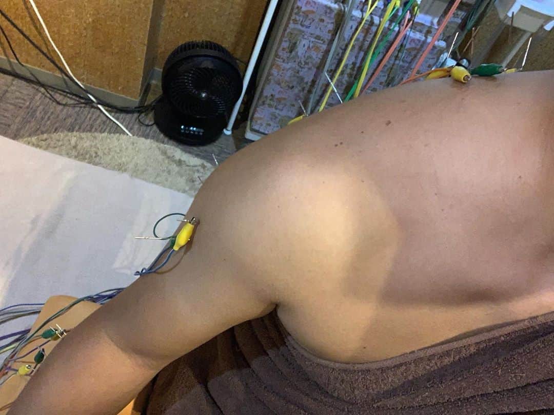 星野光正のインスタグラム：「らいおん鍼灸整骨院さんにて腕や肩などダーツとトレーニングで疲労した箇所をメンテなう。  昨日の昼飯はラーメンと辣油ソボロ飯を嫁さんとガッツいてしまったので夜は鰹のたたきのみ♪  玉ねぎたっぷり（別皿に玉ねぎ更にあります）&パクチー盛り！  多めのニンニクと生姜を溶いたポン酢をぶっ掛けて食べると美味しいよねー  パクチー苦手じゃ無ければ試してみて下さい！ また一味違って美味しいっす。  #プロダーツプレイヤー #ダーツインストラクター #ダーツ #星野光正 #エスダーツオフィシャルプレイヤー  #らいおん鍼灸整骨院  #星野飯 #三児のパパ #アラフォーパパ #料理好き #かつおのたたき」