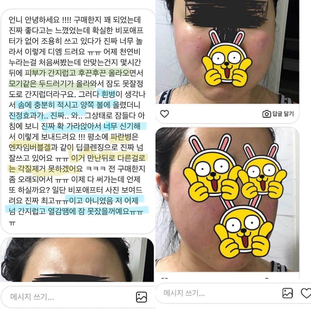 キム・ドヒさんのインスタグラム写真 - (キム・ドヒInstagram)「- 후기가 너무 많아서 추리고 추렸는데도 넘쳐나는 클린워터 후기들💙 (뒤로 넘겨주세요) 클린워터는 다른제품들과 달리 저에게 정말 특별한 제품 이에요😌 만성홍조+나비존의 넓은모공에서 탈출 시켜 줬거든요 (저는 볼에 열이 늘 차있어서 홍조가 너무 심했구요,  열이 차있으니 당연히 모공도 많이 커지고 늘어져 있었어요ㅠㅠ )_ 피부가 정말 건강해지는 신기한 경험을 알려야겠다 마음먹고_ 7년전 처음 뷰티마켓을 시작한 계기가 되었답니다 :)  . . 정말 소수의 샵에서만 만날수 있던 클린워터를_ 처음 sns 마켓에 입문시킨 건 바로 저랍니다🥳_  많은분들이 좋은제품 아셨으면 했는데,  제가 셀클레어 런칭 준비하면서 클린워터 알리는데 소홀했어요😭 . 다들 아실거라 생각하고 따로 설명을 안했는데, 새로 유입된 고객님들도 계시니_ 이제 다시 클린워터 알리미를 시작해야겠어요😆♥️ . . ✨✨전지*, 한지* 언냐들도 직접 비용을 지불하고 받는_ 고가의 관리 클린워터 워터테라피를 집에서 홈케어 하세요🙈✨_ . . 워터테라피 개발하신 원장님께 직접 물건 받고 있답니다 원장님은 우리나라에 경락을 최초로 알리신 분이시기도 하세요👍🏻. . . 클린워터는❓_ ✅물보다 작은 분자로 피부 깊숙히 침투. ✅피부 열을 내려 홍조를 하얗게. ✅모공은 쫙!! 쪼여주고. ✅좁쌀,트러블은 깨끗하게. . . 모공,홍조가 심하지 않은분들은 빠르면15분  모공,홍조,트러블 심한분들은 매일 팩해준다고 하면_ 최소 일주일안에 개선효과가 눈에 바로보여요 . . 💧화학성분X, 첨가물X, 점성X 💧무향 , 무취, 무색  ✔️임산부, 신생아 모두 사용 가능 . . 🐳 클린워터 파란병 ▫️물보다 작은 입자로 피부속까지 침투 ▫️OH-수산화이온 풍부 ▫️미네랄 풍부 ▫️미세먼지 모공 세정 ▫️모공수축 ▫️피지조절 (팩으로사용) ▫️피부열로 인한 홍조 (팩으로 사용) . . 🐳 클린워터 흰병 ▫️물보다 작은 입자로 피부속까지 침투 ▫️H+ 수소 이온 풍부 ▫️산소용존량 풍부  ▫️트러블 진정 (팩으로 사용) ▫️피부 열 내림 (팩으로 사용) . . 클린워터(흰병+파란병). 퓨리파잉솔루션(고농축 스킨,즉각적 미백과 트러블진정팩). 고농축 알로에젤. 모든 제품은 워터데이지에서 구매 가능하세요❤️ 프로필 링크타고 블로그로 오시면 모든 제품 자세한 설명 있습니다 . . #워터데이지#워터데이지마켓#에스테틱#에스테틱마켓#클린워터#워터테라피#클린워터워터테라피#모공#홍조#트러블#트러블화장품#모공수축」8月7日 21時10分 - dohya_kh