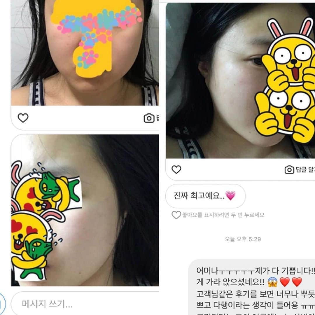 キム・ドヒさんのインスタグラム写真 - (キム・ドヒInstagram)「- 후기가 너무 많아서 추리고 추렸는데도 넘쳐나는 클린워터 후기들💙 (뒤로 넘겨주세요) 클린워터는 다른제품들과 달리 저에게 정말 특별한 제품 이에요😌 만성홍조+나비존의 넓은모공에서 탈출 시켜 줬거든요 (저는 볼에 열이 늘 차있어서 홍조가 너무 심했구요,  열이 차있으니 당연히 모공도 많이 커지고 늘어져 있었어요ㅠㅠ )_ 피부가 정말 건강해지는 신기한 경험을 알려야겠다 마음먹고_ 7년전 처음 뷰티마켓을 시작한 계기가 되었답니다 :)  . . 정말 소수의 샵에서만 만날수 있던 클린워터를_ 처음 sns 마켓에 입문시킨 건 바로 저랍니다🥳_  많은분들이 좋은제품 아셨으면 했는데,  제가 셀클레어 런칭 준비하면서 클린워터 알리는데 소홀했어요😭 . 다들 아실거라 생각하고 따로 설명을 안했는데, 새로 유입된 고객님들도 계시니_ 이제 다시 클린워터 알리미를 시작해야겠어요😆♥️ . . ✨✨전지*, 한지* 언냐들도 직접 비용을 지불하고 받는_ 고가의 관리 클린워터 워터테라피를 집에서 홈케어 하세요🙈✨_ . . 워터테라피 개발하신 원장님께 직접 물건 받고 있답니다 원장님은 우리나라에 경락을 최초로 알리신 분이시기도 하세요👍🏻. . . 클린워터는❓_ ✅물보다 작은 분자로 피부 깊숙히 침투. ✅피부 열을 내려 홍조를 하얗게. ✅모공은 쫙!! 쪼여주고. ✅좁쌀,트러블은 깨끗하게. . . 모공,홍조가 심하지 않은분들은 빠르면15분  모공,홍조,트러블 심한분들은 매일 팩해준다고 하면_ 최소 일주일안에 개선효과가 눈에 바로보여요 . . 💧화학성분X, 첨가물X, 점성X 💧무향 , 무취, 무색  ✔️임산부, 신생아 모두 사용 가능 . . 🐳 클린워터 파란병 ▫️물보다 작은 입자로 피부속까지 침투 ▫️OH-수산화이온 풍부 ▫️미네랄 풍부 ▫️미세먼지 모공 세정 ▫️모공수축 ▫️피지조절 (팩으로사용) ▫️피부열로 인한 홍조 (팩으로 사용) . . 🐳 클린워터 흰병 ▫️물보다 작은 입자로 피부속까지 침투 ▫️H+ 수소 이온 풍부 ▫️산소용존량 풍부  ▫️트러블 진정 (팩으로 사용) ▫️피부 열 내림 (팩으로 사용) . . 클린워터(흰병+파란병). 퓨리파잉솔루션(고농축 스킨,즉각적 미백과 트러블진정팩). 고농축 알로에젤. 모든 제품은 워터데이지에서 구매 가능하세요❤️ 프로필 링크타고 블로그로 오시면 모든 제품 자세한 설명 있습니다 . . #워터데이지#워터데이지마켓#에스테틱#에스테틱마켓#클린워터#워터테라피#클린워터워터테라피#모공#홍조#트러블#트러블화장품#모공수축」8月7日 21時10分 - dohya_kh