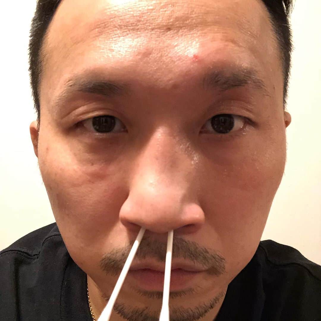 のインスタグラム：「ニュースで発表されましたが、ホルヘに陽性反応が出たと言う事で、昨日、PCR検査を受けてきました  月曜日にホルヘの施術をした彼女も無事、陰性でした  インフルエンザ式の綿棒鼻グリグリ 痛かった  #新型コロナウイルス #pcr検査 #陰性」