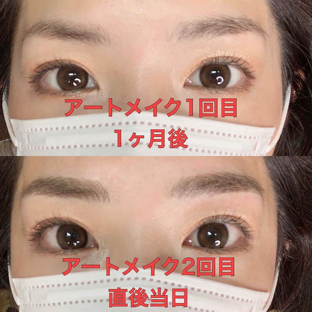 のインスタグラム：「2020.08.09 おはようございます🌞  ・ ・ 眉毛のアートメイク、メディカルブロー(@medicalbrows_nagoya )  へ行ってきたよ✨ ・ ・ 1回目の施術から1ヶ月くらい経ってかなり自然な感じに馴染んだよー！ ・ 部分的に薄いところが出てきたりしてたので2回目で微調整してもらいながら整えて貰いました♥️ ・ ・ ・ ほんとに自分で見てもどこから自眉なのか分からない🤣 スワイプして動画見てみてね👉 ・ ・ アートメイクしてからメイク時間がかなり短くなった✨ ・ あと数日眉毛のお手入れサボっても 眉毛のガイドラインがすでにあるから手入れしやすい！ ・ ・ 何よりすっぴんになった時も、違和感なく眉毛がちゃんとある事に感動😭♥️ ・ 眉毛あるから、色付きのリップクリーム塗るだけでなんとなくメイクしてる風になるw ・ まだ今日は眉毛濃いけど、馴染むの楽しみ☺️ ・ ・ ・ 担当も前回と同じ金山さん(@medicalbrows_kanayama )にお願いしたよ♥️ ・ ・ ・ 今回も全く痛くなくて、終わるまで寝てた🤣🤣🤣 ・ でも痛みは個人差あるみたいなのでご注意を🥺 ・ ・ ・ #Medicalbrows#メディカルブロー#メディカルブロー名古屋#アートメイク大名古屋#アートメイク#メディカルアートメイク#6Dストローク#アートメイク眉」