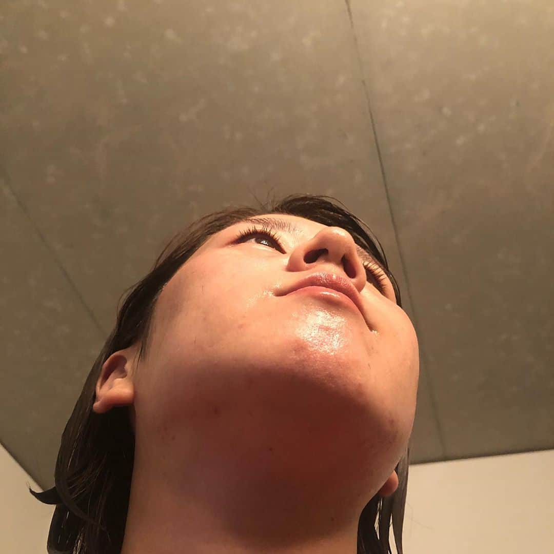 藤井瑞希さんのインスタグラム写真 - (藤井瑞希Instagram)「・ ・ 先に言います。 ３枚目の写真は肌荒れすぎて 見て不快になる方がいると思いますので、気をつけてください🙇‍♀️ ・ 汚いと思った方も多いですよね。 すいません😢 恥ずかしいけど今日は載せちゃいます。。 ・ いつもお世話になっている東京ヒルズクリニックさん。 ・ ３枚目の顎ニキビができ始めたのが去年の夏‼️ ２枚目が昨日の写真です‼️ ・ 東京ヒルズクリニックに行き始めて一年でこんな綺麗になりました😭💓 ・ 1年前喉を痛めてからマスクをつけるようになり、この顎ニキビができてしまい、本当に落ち込みました。。 ・ 元々肌が弱く荒れやすい私は、この時人に会うのも嫌になるくらい、肌荒れに悩んでいました🥺 ・ しかし、ヒルズクリニックに出会いしっかり通うことで、今は肌が綺麗だねと言っていただけることも増えて、可愛いねとかよりもその一言がとにかく嬉しいです💓 ・ 女性って本当に肌でテンション左右されるんです😭 ・ 今もたまーに肌荒れするけど、昔と違って、ここに行けば治してくれる‼️治る‼️って思える場所を見つけたので安心しています☺️ ・ 先生、ヒルズクリニックの皆さんいつも本当にありがとうございます😊✨ ・ ・ #東京ヒルズクリニック #肌トラブル #マスクニキビ #肌荒れ #美肌ケア #ニキビ #美容クリニック #敏感肌」8月9日 9時00分 - bdmntnfujiimizuki