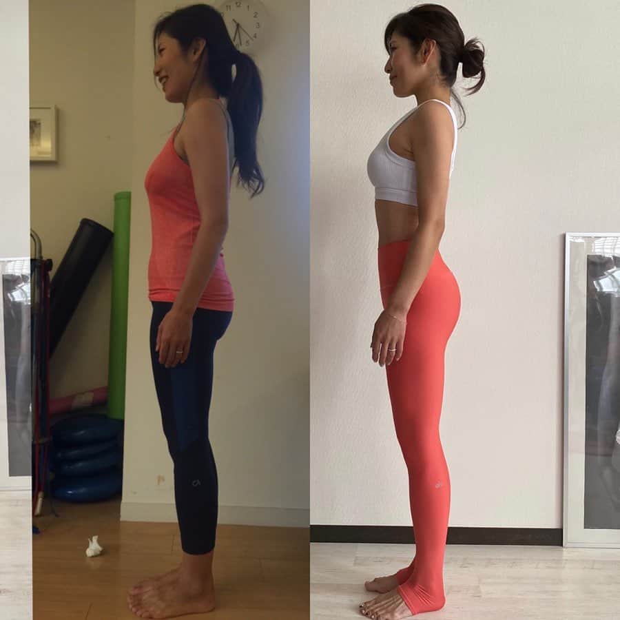 村田友美子さんのインスタグラム写真 - (村田友美子Instagram)「この二枚の写真痩せてみえるのはどっち？ 右ですよね。。。 でもなんと‼️右のが体重は重いんです‼️  産後太りと思いきや、 骨の歪みにより太って見えるケース。  無理な食事制限やストイックな運動で体重ばかりを減らそうとしてはいませんか？  姿勢や骨を改善し日常生活を 過ごすようになると、筋肉のつき方や脂肪のつき方が全く変わり、体重は変わってない、もしくは増えているのに、痩せたように見えたり、バランスがよくなり、抜群にスタイルがよく見えるように変わります。  うちの人気トレーナーnao先生 @nao_ota930  42歳で2人目を出産。 現在45歳ですが驚くほどカラダが変わりました。写真より実物のが100倍キレイ😎  比べてみると胸の位置、股の位置、くびれ位置、お尻の位置、首の位置、、、あげたらきりがないほど骨が変わっています。  なお先生はもとCA✈️だったので 自分の姿勢はかなり良いと思っていたようですが、実際横から見ると首は前にでていて肩もまいています。美しく見せるために胸はひらいていますが、実は全部前に重心がある隠れ猫背前ももがちがちタイプ。  年月はかかりましたが全身の歪みを少しづつ治し、憧れの下半身痩せにも成功しました！  骨の歪みは太り、たるみ、痛みの原因です。  体重にこだわらず自分の力で歪みを治すぞ！と思ってくれるひとが増えてほしいなと思っています。  お尻が垂れているのは内股のせいだし、顔が大きくなるのは猫背のせい。。  私たちは姿勢を変えて本当に人生が変わりました。  新しい自分になれるメソッド。  オンラインやスタジオで頑張っていらっしゃる皆様。 なお先生がカラダを変えたように 私や他のトレーナーがカラダを変えたようにみなさんにも最短で変われるレッスンを全力でお伝えして参ります。  ただ！時間は多少かかります。 骨格！カラダのフレームを治しているわけですから！ 私たちも少しづつ少しづつ変わり今があるんです。。。  #体重に振り回されないで #右のが体重重い #産後太りと見せかけて #骨の歪みだった #赤ちゃん10カ月もお腹にいて 出産するわけだから #そりゃあ歪みますよね #赤ちゃんいなくても #猫背 #巻き肩 #腰丸める #足組む #不良姿勢を続けていると #歪みは自分のものとなります #でも自力で治せます #時間なくても週一やれれば大丈夫 #やらないよりやる #筋肉や脂肪の形が変わり見え方が変わる #新しい自分になる #おnewな自分 #私はいまの自分が一番好きです #ユミコアオンラインレッスン #おもろいレッスン #本気で変わるレッスン @onlineyumicore  @yumicorebodyofficial  #yumicorebody」8月10日 15時58分 - yumicorebody