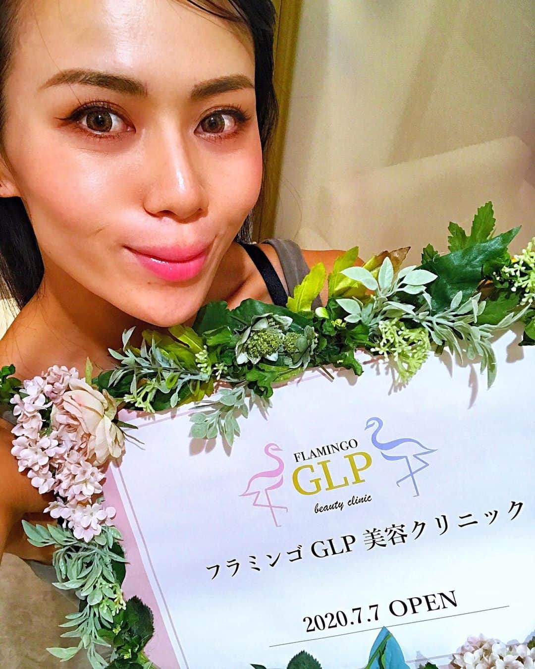 のインスタグラム：「・ @flamingo_glp1 さんでエラボトックスして2週間ちょっと経ったよ✨  前からトレーニング中の噛み癖が酷くて、エラが気になっていたから 顔がスッキリしてほんとうに嬉しい🥺  #フラミンゴGLP美容クリニック　#glp1ダイエット　#HIFU #ハイフ　#ダーマペン　#水光注射」