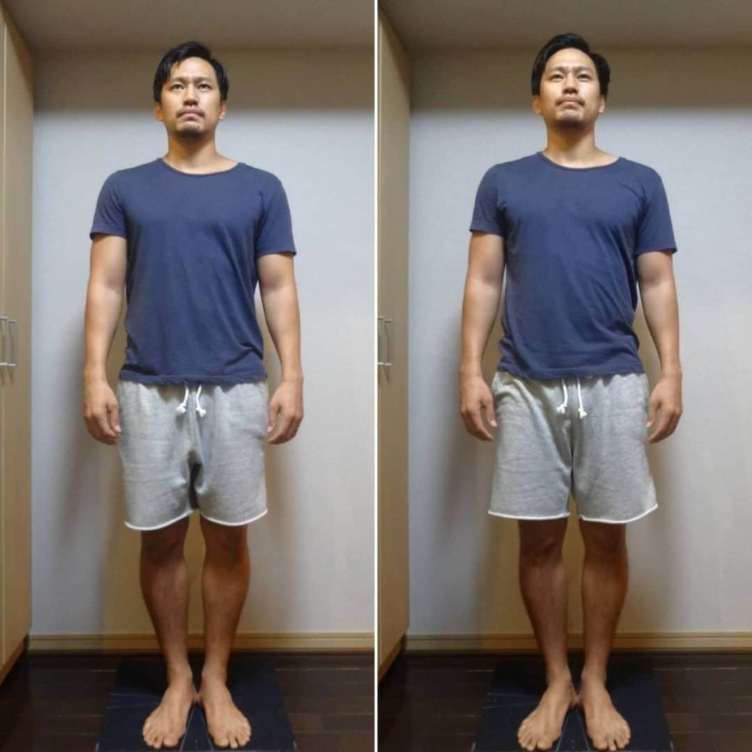 小柳心のインスタグラム：「またいってきましたよ。マスク・ド・ゴッドハンドにやられてきましたよ。 前回動画撮ってくるっていったんですけど、動画結構長い尺になったもんでYouTubeに載せましたわ。 ノーカットでお送りすると思うので、ぜひ見てみて。リアルタイムで身体のゆがみ取れてくの。 (プロフィール→リンク→YouTube)  で今回ね。 この画像見て皆さま「え、あんま変化ないやん」って思うじゃん？ 見た目は確かに前回の方が凄いよ？ 段ボールハウスが一軒家になったくらいの差があったからさ？ 確かに今回は中古一軒家の築年数が変わったって感じの変化なの。わかってる。わかってるの。  とにかく何が言いたいって、身体の連動性がヤバいのよ。 凄いの。脚からの力が全身に直で伝わるのよ。 騙されたと思ってスクワットやってみて。ヤバいから。 それと「効く」のよ。狙ったところに直で。今まで頑張ってキレイなフォームでやってたけど、歪んでるとそれって結局歪んだ状態でのキレイなフォームなのよ。 サイドレイズとかバカ効くから。かなり重傷らしい肘も、少し治して貰った結果これよ。今までの自分ほんとよく頑張ってた。偉い。グチャグチャな身体でよくここまで頑張った。  でさ、ゆがみをとってもらったからさ、立ってられるわけ。 立ってられる？いやほんと長時間立ってられなかったんよ。今ストンって感じ。全体重がぴったり身体から地面に落ちていく感じ。全然つかれない。 稽古中に演出家に言われたの。 「小柳を見てみろ！微動だにせず立ってるじゃないか！武士とはこういう事だ！」 自分不器用ですから面してうつむいたけどさ、正直ゴッドハンドに歪みとってもらった直後だったから立ててたんだよね。内緒。  でさでさ、また何が凄いってさ。 これ、PR記事じゃないのよ？(笑) 私も普通に通ってるの。ただあんまりにも効果が感動しちゃったもんだからこうして投稿してる次第なの。  興味のある方は @brginza905 さまへDMを！  早くまた行きたいー！  #とにかく着てるTシャツが斜めで本当に申し訳ない」