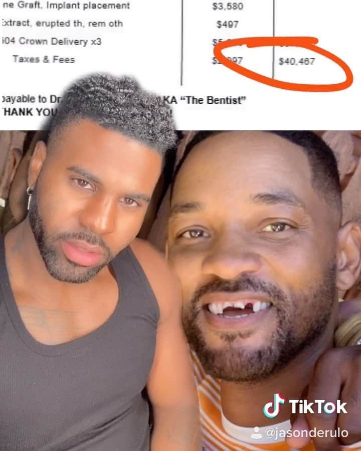 ジェイソン・デルーロのインスタグラム：「Just got the bill back from @thebentistofficial for @willsmith ‘s dental reconstruction 💀」