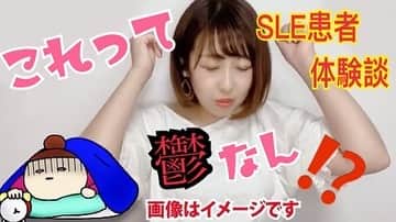 夏目亜季のインスタグラム：「【情報発信の難しさを改めて痛感】  今日の動画はこちらです。  👇 『SLEなん？鬱なん？すごく悩んだ事』 https://youtu.be/jRiWCjViHvE  以前からリクエストのあった「体験談」をもっと話して！ のパート２です。 きっとステロイド治療している方や全身性エリテマトーデスの方はもちろん 産後鬱や他の疾患の人ももしかした共感できることはあるんではないかなぁと思います。  そして改めて思うことは情報発信の難しさです。 初めてブログを書いたのは中学生でそこからほぼ毎日何らかの形で 情報発信を続けていますが、中高生時は地元のこと日常のこと ２０歳を超えて芸能の仕事をしてからはファンに向けて・・・。 なので「理解してもらう」「教える」ことを意識したことはそこまでありませんでした。 書きたいままに書くことが多かったように思います。  今は政治家としてより多くの方に理解できるよう、知ってもらえるよう わかりやすくやっている（つもり）です。 病気に関すること区の事、国の事、制度に関する事、当事者として 患者さんへの理解を深めて欲しいなどいろんな思いがあって発信しています。  区の代表でもあり、難病当事者として代弁できる立場であるからこそ、病に対する偏見をなくしたい、私と同じように「健常者に見えるからと怠けてるように誤解される患者さん」が一人でも減ればいいなという思いです。なのでヘルプマークの普及啓発や議会での質疑や提案もやるわけです。  でも自分が思っている以上に人は細部まで見ない知ろうとしない、興味がない。 『伝えるって難しい！難しすぎる！』 というの痛感しています。  やはりネットニュース一つでもそうですが、中身を見ないで批判し、見出しで 決めつけてしまう事ってよく見受けられますが基本的にはそういうもんだと思って 何度も同じようなことをまめに発信し、違うこと、誤解されている事に関しては 自ら何度も違う、と発信しなければならない、常に相手の知識は０ベースで考えて 発信しなくてはならないと思いました。  私自身も何度も発信してることに関しては 「当たり前に知ってる話」として話してしまう事もありますが １００同じことを投稿してもそれを見た１００人が１００回ずつ違う事だってある そういった気持ちを忘れず、本当に伝えたい内容・伝えなければいけない内容であれば 根気強く何度も繰り返し、くどいくらいに発信し続けることが大切だと痛感します 特にネットでのコミュニケーションは断片的部分だけ見て物事を判断してしまう人が 多数と思って発信することが大切！  改めて初心を忘れず、声がある限りこれからも情報発信に努めます。  公式ラインはこちら！登録お願いします🐹 @qnc2615k  #荒川区議会議員 #荒川区 #町屋 #西日暮里 #熊野前 #日暮里 #南千住 #荒川 #東尾久  #全身性エリテマトーデス #sle #プレドニン  #ステロイド #セルセプト #プログラフ #鬱　#躁鬱」