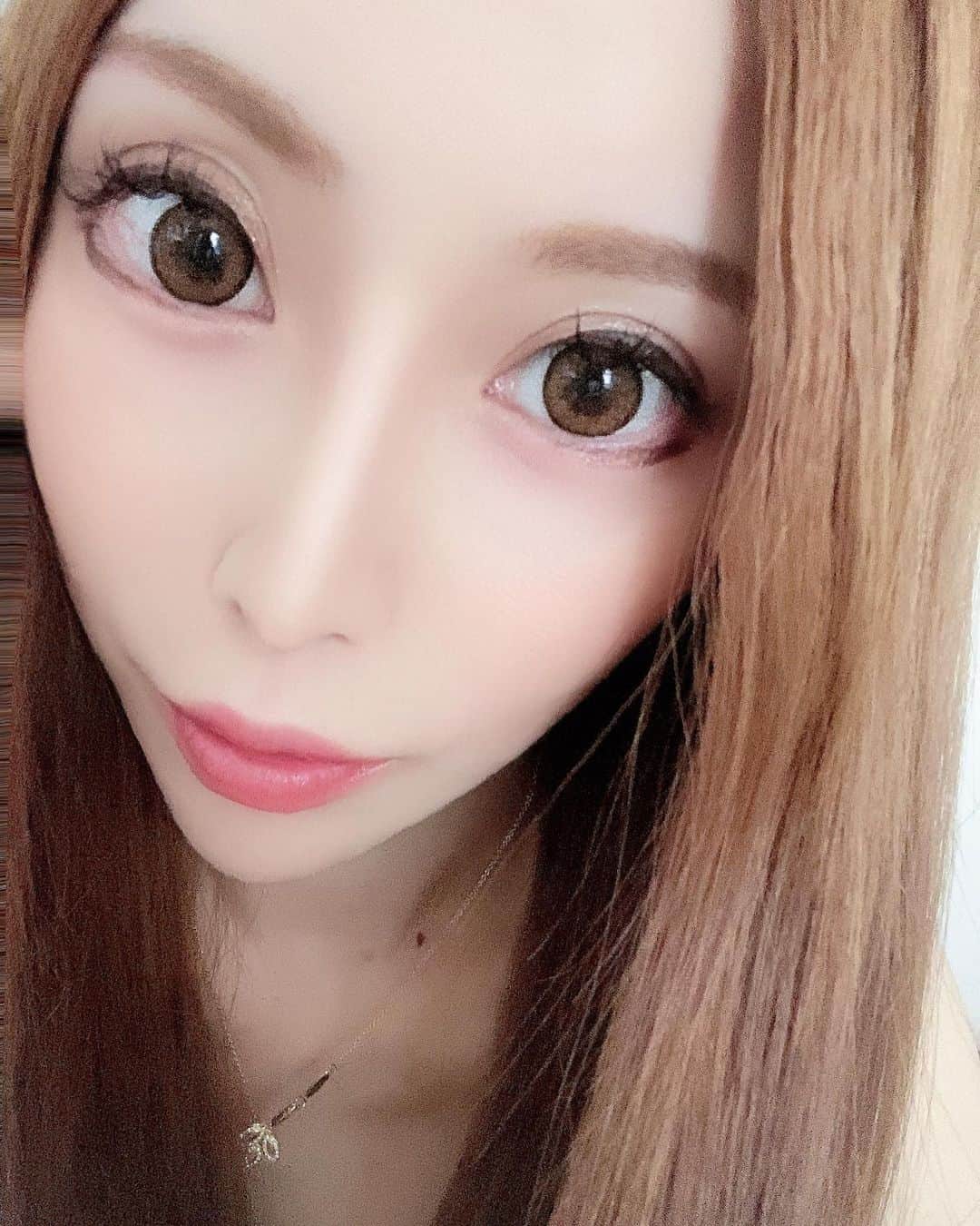 高橋沙弥華のインスタグラム：「銀座ケラシアクリニックでダブロゴールド（HIFU）受けてきた👩🏼💓  ソノクイーンよりは痛みあったけど 引き上がり感が当日から全然違う🥺  口元のたるみ1番気になってたけど ホントに効果実感😍  HIFUは当日より徐々に効果出るから これから楽しみ☺  ありがとうございました🥺✨✨  #銀座 #ケラシアクリニック #ダブロゴールド#ハイフ #hifu #美容 #医療 #クリニック #引き締め #たるみ改善 #たるみさよなら」