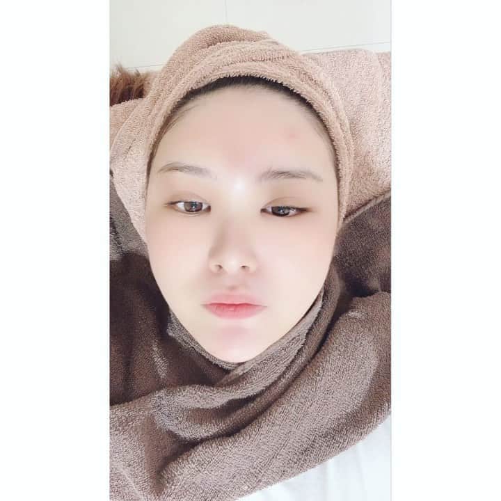 津久江麻由のインスタグラム：「. . 1枚目は無加工🕊 2枚目は加工👌(マッサージピール中) ■まだPRPでおでこと目がはれてます👌) swipe ⇨ マッサージピール中の真顔 . 東京でずっとお世話になってた #エスビューティークリニック　に行ってきました🤛🏻🤍 (この前も行きましたが笑) . あご周りと額に 小さなつぶつぶができてたから マッサージピールしました👌💞 動画を見て分かる通り ちゅるちゅるなった☺️🤛🏻 化粧ノリ最高💘💘💘💘 良かった😫💞 . あと美白が気になってて、 美白のついてるのは即試す派なので　 スプリングX（保湿)の＋美白ケア をして、 電気で内側まで保湿しました！ . 他のクリニックに比べて通いやすい値段だし 渋谷にあるから通いやすい🤘🖤 . . #医療痩身 #アンチエイジング  #レーザートーニング #医療美容 #エステ #ピーリング  #マッサージピール #お気に入りコスメ #コスメ大好き #メイク好き #デパコス #コスメ紹介 #今日のメイク  #今日のコスメ #プチプラコスメ #メイク好きさんと繋がりたい #コスメ好きさんと繋がりたい #いいね返しは絶対 #おすすめコスメ #コスメ購入品 #コスメ好き #メイク好き #スキンケア #美白 #ボディソープ #ボディクリーム #ボディケア #美白ケア #美白美容液 #美白効果」