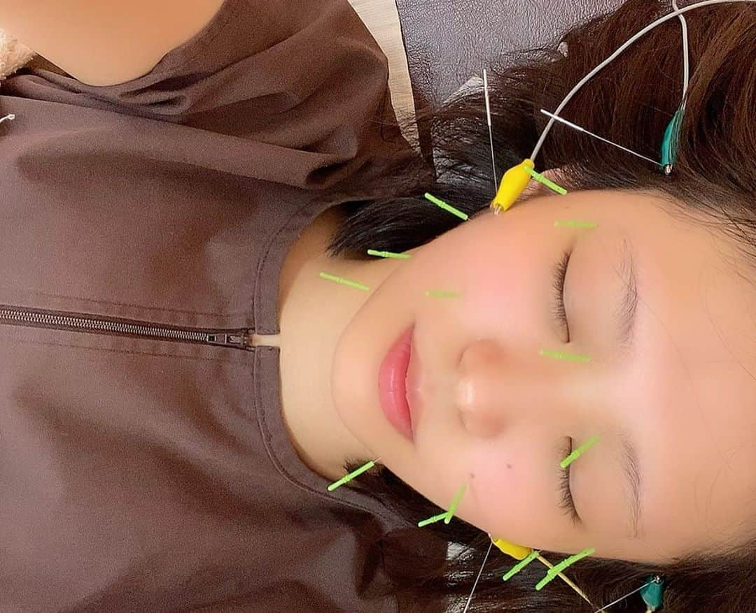 朝倉ゆりさんのインスタグラム写真 - (朝倉ゆりInstagram)「美容鍼メンテナンス💆‍♀️ 🦔 身体の調子を診てもらってから 背中とお顔に鍼してもらいました！ ． 鍼って最初怖いけどなれたらとっても 最高にスッキリする！！！ お顔には電気も流してもらったよ💡 ． 定期的に行かないとだね💆‍♀️ ． ． #美容鍼 #アンチエイジング #鍼灸 #鍼 #ありがとう鍼灸院 #磯子区美容鍼 #アンチエイジング #pr #トリドリベース」9月9日 2時47分 - eb_loverinko