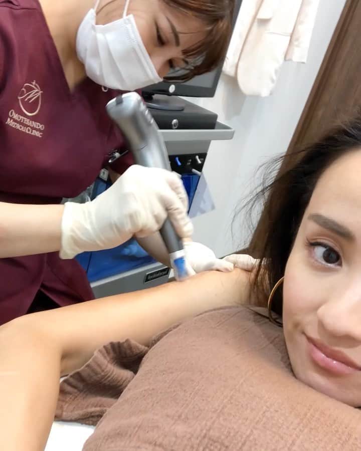 秋定麻紀子のインスタグラム：「みんな悩んでる事は同じね。 私はずーっと二の腕のプツプツに悩んでいて。 皮膚科に行って塗り薬とかもらうんだけど全然効かなくて。 @omotesando_medical_clinic で相談したら治療方法があって、定期的に治療に来てます。 おかげでだいぶ改善されてきました。 2枚目の画像で分かると思うけど白いプツプツ。 コレねー。まあとにかくしぶとい。 でも本当に良くなってきて嬉しい。  その人それぞれの肌質によって使うマシーンが違うから1度相談してみてね。  私はダーマペンで治療してます。 痛みは私の感覚だと全然大丈夫。 もちろん麻酔なし。」