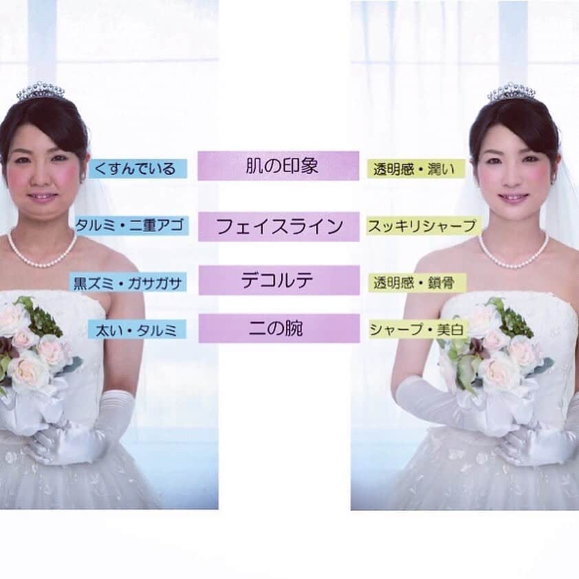 【公式】ブライダルエステサロンさんのインスタグラム写真 - (【公式】ブライダルエステサロンInstagram)「結婚式当日﻿ ﻿ 沢山のゲストから﻿ アナタは祝福をされることでしょう﻿ ﻿ と、同時に﻿ アナタのお背中や﻿ 二の腕にも﻿ 沢山の視線が集まります﻿ ﻿ 自分史上最高なアナタで﻿ 自信を持って挙式を迎えるために﻿ ブライダルエステです﻿ ﻿ 自己流のお手入れではなく﻿ 大切な日だからこそ﻿ 美容のプロにまかせましょう﻿ アユナタではこれまても沢山の花嫁様の﻿ キレイをお手伝いして多くの実績があります﻿ ﻿ まずは体験コースをご予約を﻿ ホームページからご予約くださいませ﻿ ﻿ 挙式まで3ヶ月以上ある方は﻿ まずはLINEでの無料ご相談も、﻿ お試しくださいね﻿ 事前にご不安なことやお悩みも﻿ お気軽にご相談いただけます﻿ ﻿ ﻿ :.:*:.:*:.:*:.:*:.:*:.:*:.:*:.:*:.:*:.:*:.:*:.:*:.:*:.:*:.:*:﻿ #挙式 ﻿ #ウエディング ﻿ #ブライダルエステ ﻿ #ブライダル ﻿ #軽井沢結婚式場 ﻿ #エステ ﻿ #結婚 ﻿ #式場探し﻿ #フォトウエディング﻿ #婚姻届 ﻿ #エステサロン ﻿ #エステブライダル ﻿ #エステ小顔 ﻿ #ブライダルエステ体験 ﻿ #軽井沢挙式 ﻿ #プレ花嫁準備 ﻿ #2020夏婚﻿ #2020秋婚 ﻿ #軽井沢ブライダルエステ ﻿ #佐久ブライダルエステ ﻿ #佐久市エステ ﻿ #佐久市ブライダルエステ ﻿ #結婚式 ﻿ #軽井沢婚 ﻿ #佐久市 ﻿ #小諸市 ﻿ #佐久市美容室﻿ #軽井沢 ﻿ #御代田町 ﻿ #「まずはブライダルトライアルで体験してみましょう」﻿ #ブライダルエステ 無料相談﻿ ﻿ ﻿ *:.｡. .｡.:*･゜ﾟ･**･゜ﾟ.:* 〜〜〜〜〜〜〜 ﻿ 挙式は決まっているけどエステはまだのかた。﻿ 早くはじめることをオススメします。﻿ ﻿ 「こんなにエステっていいって知ってたら﻿ もっと早く始めれば良かった」﻿ ﻿ こんなお声が良く聞かれます。﻿ まずはブライダルエステトライアルをご予約ください。﻿ ﻿ あなた様とお会いすることを﻿ 楽しみにお待ちしております ﻿ ﻿ 【結婚式・挙式をあげる沢山の花嫁へ 】　﻿ 長野県佐久市のブライダルエステサロン﻿ 「Ayu-Natah アユナタ」﻿ ﻿ 今ならブライダルトライアルコース5,500円♪ ※詳しくはプロフ欄ホームページURLをクリック‼﻿ ﻿ ﻿ ︎💐驚異のリピート率 95.8% ﻿ 北陸新幹線佐久平駅徒歩7分﻿ （10:00～20:00）」9月9日 23時57分 - ayunatahwedding