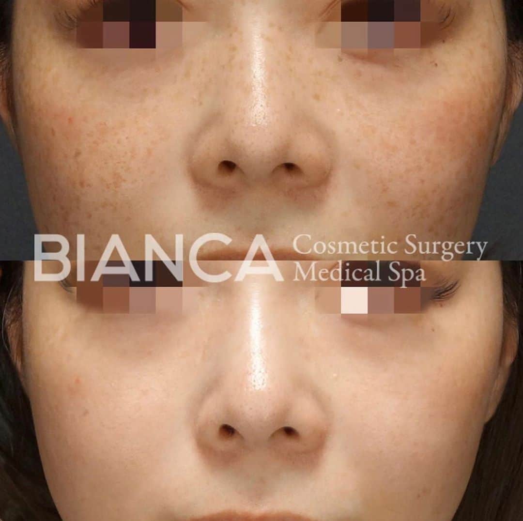 辻沢由有（BIANCA CLNIC 表参道院 院長）のインスタグラム