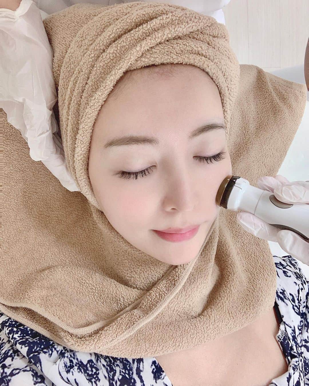 のインスタグラム：「昨日はえみりちゃんのクリニック VENUSクリニックへ👼💓 (@venus_beauty_clinic ) (@emiri_aizawa ) . シミ取りが落ち着いてきたから 久々にプラズマシャワーしたよ🙌💕 . 【プラズマシャワーとは】 プラズマと呼ばれるイオン化させた気体を、 トラブルが起きているお肌に 集中的に照射することで さまざまなお肌のトラブルを改善していきます。 . 肌荒れ、にきび、くすみ、毛穴に関する悩み、小ジワ、ほうれい線などの改善 . プラズマシャワーをしたら 肌のトーンめちゃくちゃ上がるし 肌がふっくら柔らかくなるの🥺💓 . 化粧ノリがバッチリになる！ 撮影前だから肌の調子を 整えないといけないからね😌✨ . M22(シミ取り)と プラズマシャワー本当に好き💓 . #venusclinic #ビーナスクリニック#新宿#プラズマシャワー#肌質改善#ニキビケア #くすみケア#毛穴ケア#肌ケア #肌荒れ改善」