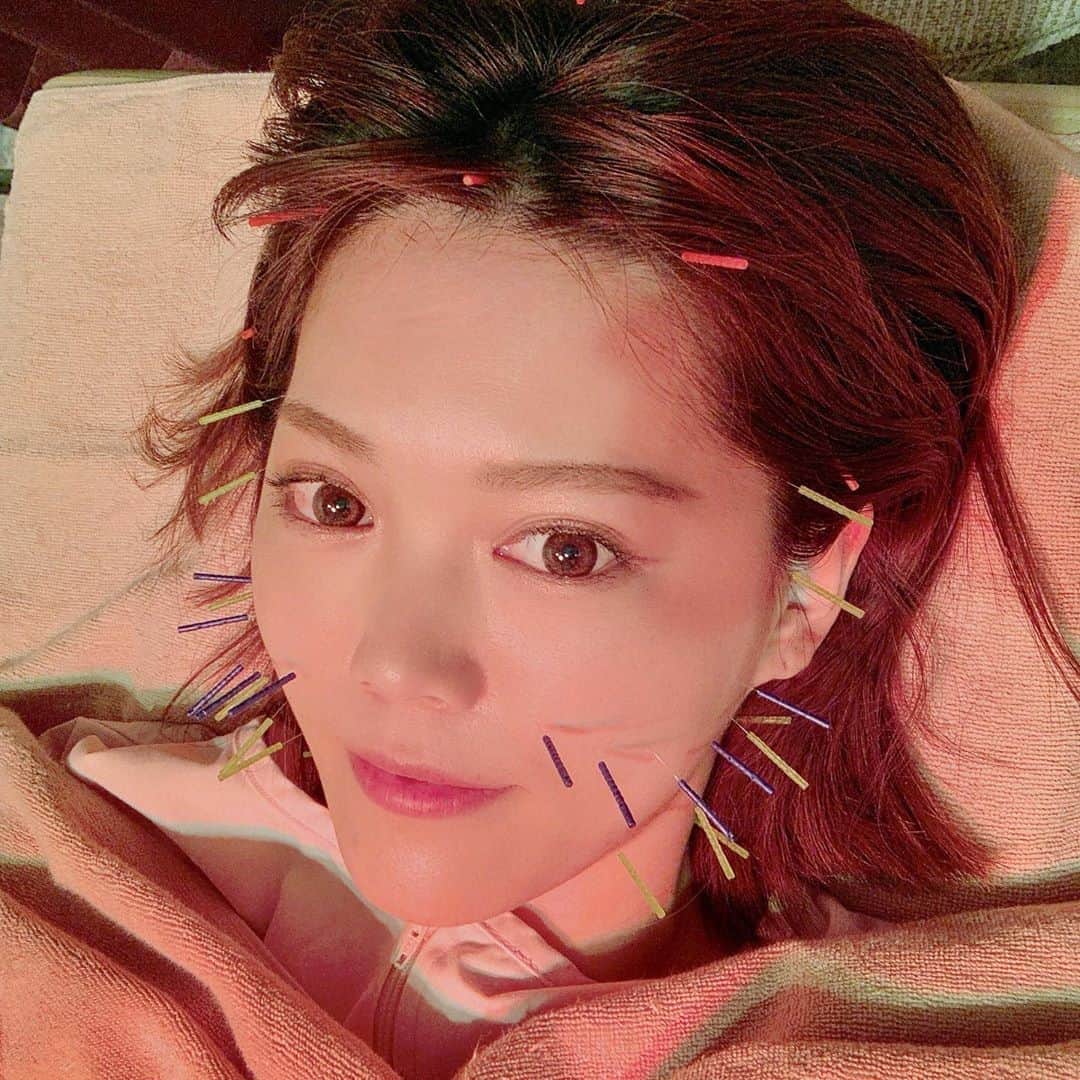 上坂由莉のインスタグラム：「﻿ ﻿ こんばんは🌙﻿ 一昨日は月１の美容鍼で﻿ 世田谷ビューティクリニークへ💆‍♀️ @sbc.tokyo ﻿ ﻿ 今回はボディ(首、肩、背中)から施術してもらいました❗️﻿ ちょっと前に首鞭打ちみたいになってたんが﻿ だいぶよくなってたけど、鍼でさらにスッキリ🙋‍♀️✨﻿ ﻿ ﻿ 今回顔は歪みなどもほぼなく🙆‍♀️﻿ でも食いしばっているのか左の咬筋だけ﻿ 硬くなってしまって触られても硬いのがわかるほど💦﻿ なのでお顔の下半身を多めに鍼を打ってもらったよ❤️﻿ ﻿ ﻿ 毎回先生との美容トークが楽しくて楽しくて🥰﻿ 使ってる基礎化粧品や下地がディレイアで同じなので﻿ 良さを実感してるのを報告しあってます😂💓﻿ ディレイア @grazia_direia の基礎化粧品などは﻿ 世田谷ビューティクリニークでも購入できますよ😘﻿ ﻿ ﻿ 来月は２回行こうと思うのですでに予約済み📌﻿ ヨガやトレーニングでメンテナンスはしてますが﻿ 行き届かない細かなところは鍼などで﻿ 調整してもらってます💆‍♀️﻿ 来月も楽しみやなぁ❣️﻿ ﻿ ﻿ #世田谷ビューティクリニーク #美容鍼 #鍼灸治療院 #鍼灸院﻿ #池尻大橋 #世田谷 #東洋医学 #小顔調整﻿ ﻿」