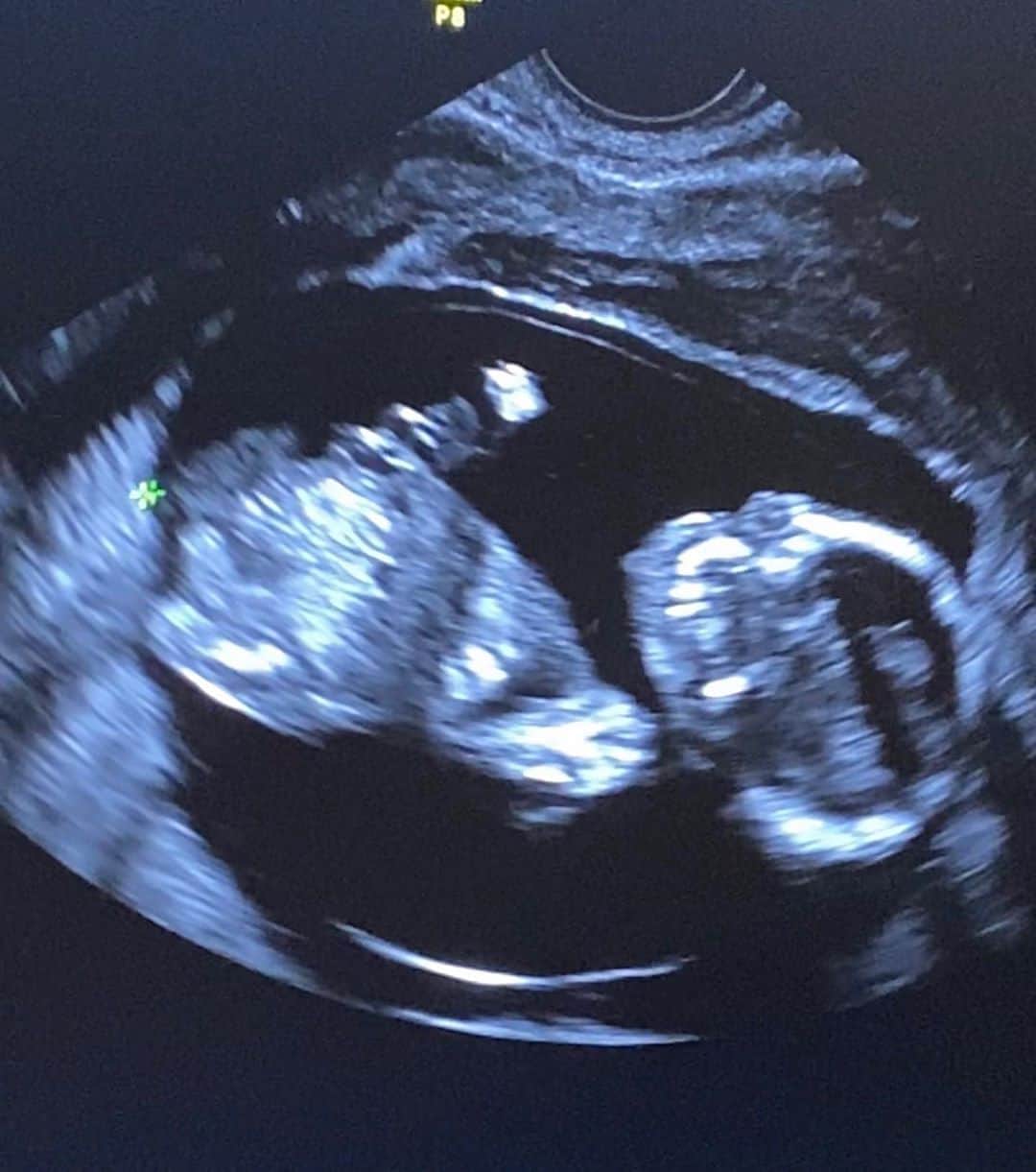 グッチ・メインのインスタグラム：「My baby otw 🥶🏹」