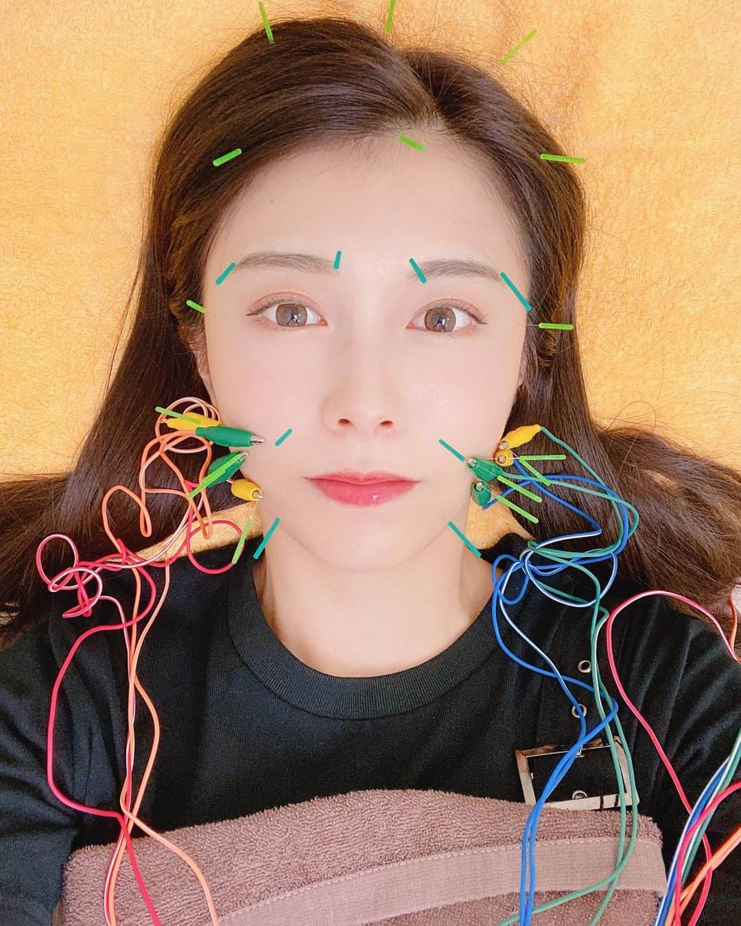 麻衣愛のインスタグラム：「美容鍼に行ってきました!!💉 何故か頭が硬すぎて、いつもは顔面だけだけど今回は後頭部にも鍼をさしてもらいました!!💦 眉間が1番痛かったけど、終わった後目の開きが倍くらいになっててすごくスッキリしました☺️🎵 #美容鍼 #鍼灸院 #美容鍼灸 #美容 #美容day #美容研究 #美意識 #beauty #エステ」