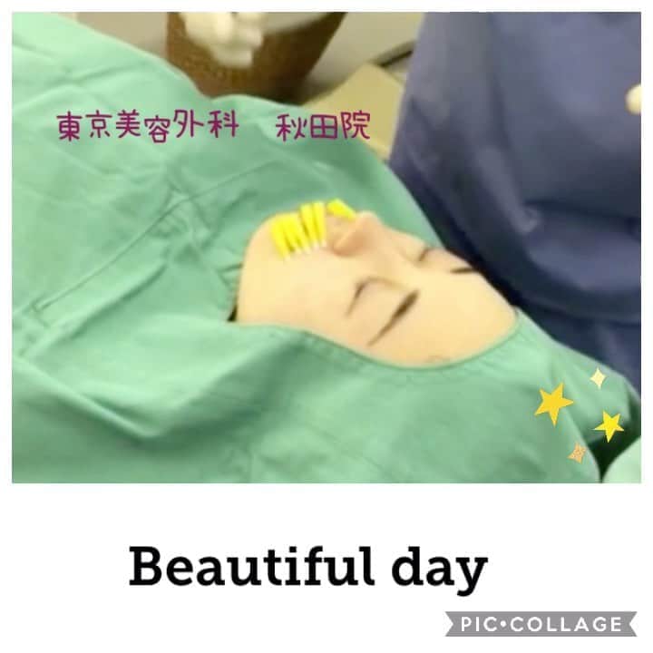 東京美容外科公式のインスタグラム：「💚東京美容外科　秋田院です💚 . 暑い日が続いており夏らしい毎日ですがいかがお過ごしでしょうか😌体調管理には引き続きお気をつけ下さいね☺️ . 老化予防、アンチエイジングに ショッピングリフトは いかがでしょうか☺️ . ショッピングリフトとは、 非常に細い針につけられた極細糸を皮膚内に挿入することで、糸の周りの皮下組織のコラーゲン再生を促進をはかる治療です。お肌のハリ・肌の色、毛穴の引き締めなどの肌質改善の高い効果が見込めます。 針を挿入して抜くだけの簡単な施術ですので、施術時間も短く、安全、手軽に受けていただくことが可能です。 術後のダウンタイムがほとんどなく、手軽に始められる治療の一つです。吸収糸を使っているので、ショッピングリフトの糸は1年～1年半で吸収されます👩🏻‍⚕️ . お若いうちからの老化予防は非常〜に大切です👩🏻‍⚕️✨ ご予約お待ちしております👨‍⚕️✨ . . . . ==🎁お問い合わせはこちら🎁==== 詳しくはプロフィールのURLから公式サイトへ♪ ▼フリーダイヤル 0120-658-958 （コールセンター受付時間：9：00～21：00） ▼LINE予約 @ tkc110 ============== #東京美容外科 #東京美容外科秋田院 #美容整形 #美肌#美容好きな人と繋がりたい #綺麗になりたい#美容ナース募集中#秋田#美容外科 #秋田院の202008#予防美容#美白#コラーゲン#老化予防#美肌治療#ハリ#艶肌#たるみ治療#しわ#抗酸化#スタッフ愛用#アンチエイジング#ショッピングリフト#クリニックコスメ#医療専売品#たるみ#8月23日#8月#ナース求人中#たるみ治療なら東京美容外科」