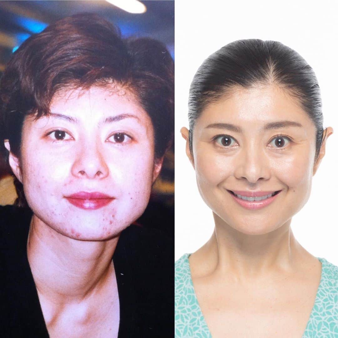 間々田佳子のインスタグラム：「コアフェイストレーニングを やっててよかった…と 思う瞬間  この写真は20代後半だったかな…  #間々田佳子 #コアフェイストレーニング #表情筋研究家 #にきびケア」
