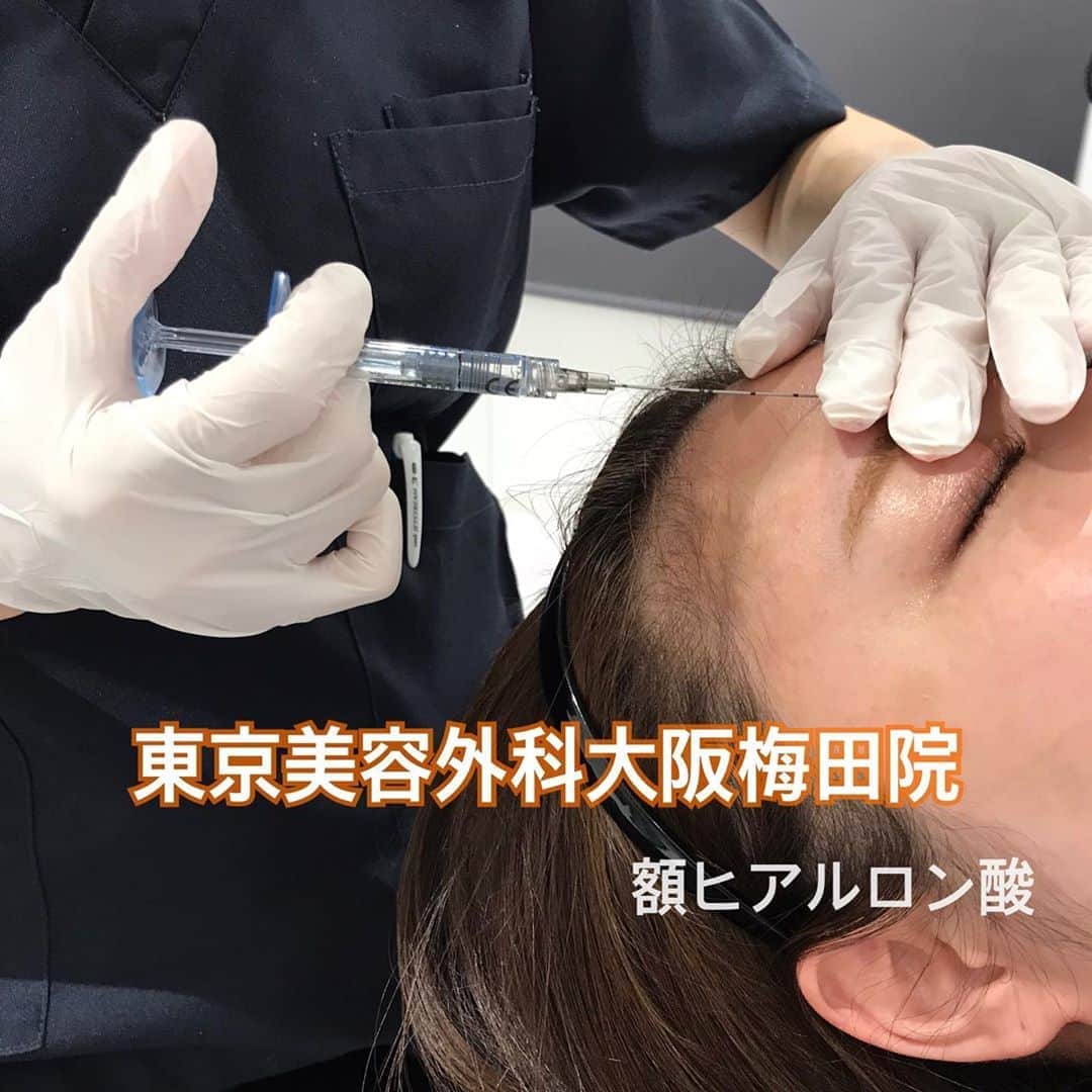 東京美容外科公式のインスタグラム：「こんにちは🌻 東京美容外科梅田院です😊 今回は額のヒアルロン酸の施術をご紹介します🙋‍♀️✨ 短時間でお顔の印象を変えることができるヒアルロン酸注入法は人気の施術です😌🎶 まんまるなおでこは女性らしさもUPします🐣  詳しい内容やヒアルロン酸の種類、ご料金につきましてはカウンセリングでご相談下さいませ🧡  ==🎁お問い合わせはこちら🎁==== 詳しくはプロフィールのURLから公式サイトへ♪ ▼フリーダイヤル 0120-658-958 （コールセンター受付時間：9：00～21：00） ▼LINE予約 @ tkc110 ============== #東京美容外科 #東京美容外科梅田院 #美容整形 #きれい #整形 #美活 #綺麗になりたい #美意識  #美容外科 #プチ整形 #アンチエイジング #美容好き #美容整形外科 #beauty #コンプレックス#Osaka #大阪#梅田 #美容クリニック #ヒアルロン酸#額ヒアルロン酸」