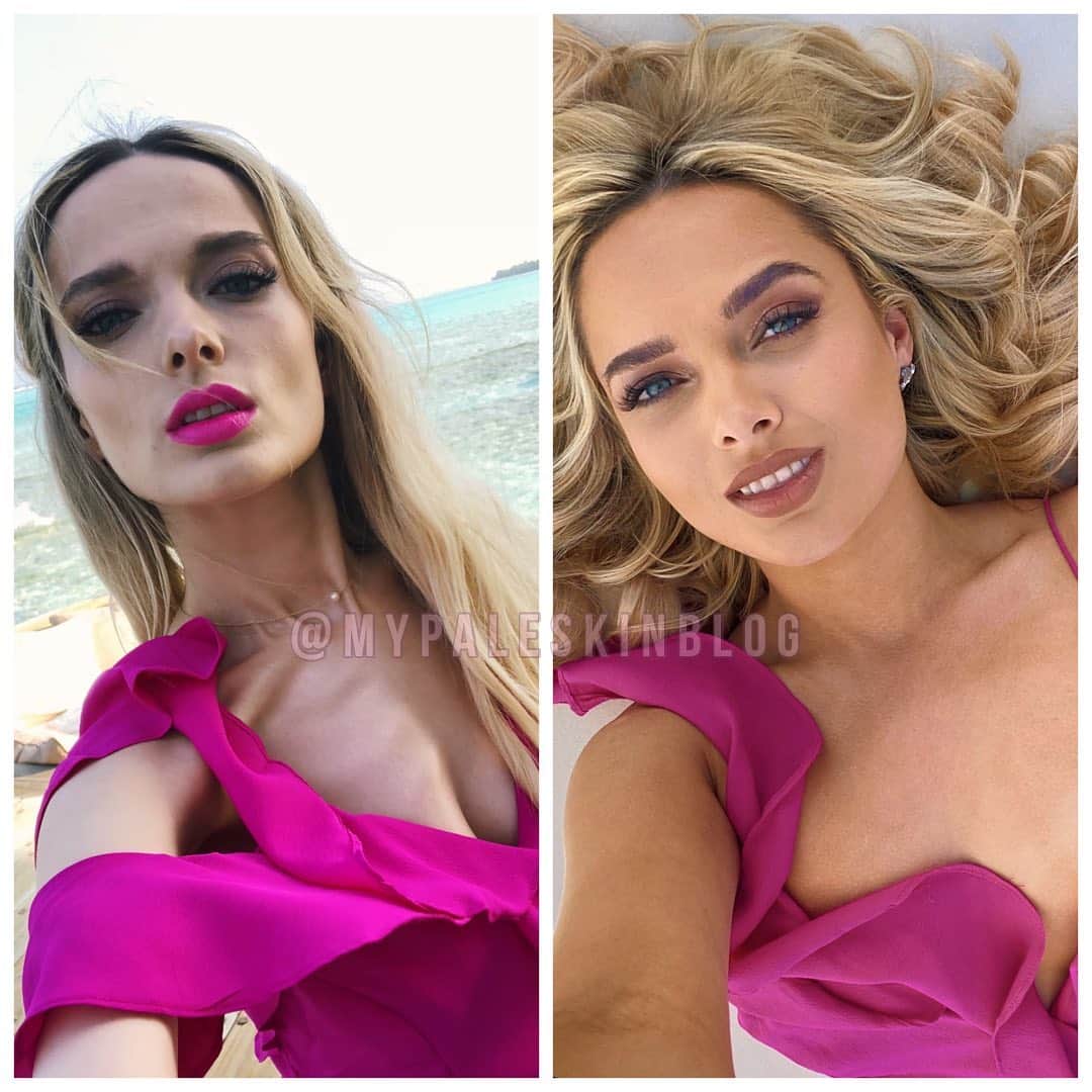 のインスタグラム：「Sis, the real glow up is internal 💗. ⠀ The exact same dress, but two years, 20ish lbs, and what feels like two realities apart. 100% cried my eyes out looking at the difference between these two pictures 💔. ⠀ The picture on the left was one I took whilst in the Maldives in 2018. The picture on the right was yesterday in Santorini. ⠀ It’s difficult to explain everything that’s happened in the past couple of years, and how much things have changed in my life since breaking free of an environment that was killing me, both inside and out. ⠀ I would give anything to go back in time and just hug that girl on the left, get her a support network, explain to  her about what a healthy relationship looks like, and show her how to live, rather than just survive.  ⠀ The comeback is always stronger than the setback 💗 so buckle up, because I haven’t even glo’d up yet - this is just a lil spark ✨. ⠀ #mypaleskinblog #recovery  #beforeandafter #transformation #transformationtuesday #glowup #recoveryispossible ⠀ ⠀」