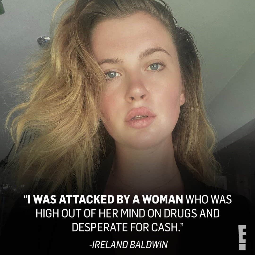 E! Onlineさんのインスタグラム写真 - (E! OnlineInstagram)「Ireland Baldwin received an outpouring of support after revealing that she was attacked by a woman on Saturday. The photos she shared and her detailed account of the incident are at the link in our bio. (📷: Instagram)」8月24日 3時02分 - enews