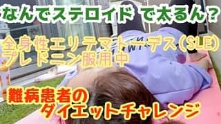 夏目亜季のインスタグラム：「【新着動画】  女子の大敵！🥱😫 ステロイド の見た目に出る副作用をおさらい。 これをみて『なるほど』となってくれたら嬉しいです。 見た目でわからない病をかかえてる方はたくさんいて頑張ってても薬が多いとかなり痩せづらいなんて事はたくさん経験してきた。😢  やっとプレドニン が2mmになって、8月頭あたりから糖質オフを心がけてきましたが、 それだけじゃ前のようには変化がほとんどないので 糖質、タンパク質と適量にとりつつ運動もしていきます。 続くか心配なので頑張る気持ちも込めて3分の動画に収めました。  ステロイドについてかなり解説してるのでみてほしい😚  インスタにはurlリンクされないのでYouTubeで『夏目亜季チャンネル』で検索！  【SLE】難病患者とダイエット！どうしてステロイド飲むと太るの？【全身性エリテマトーデス】 https://youtu.be/uXKkz-Or8f8 @YouTubeより  また前回の動画はステロイド服用の患者さんから 『髪』についてのリクエストもあったので 私の立場で美容系はどうかなぁ？とたまに 思う事もあるけどやっぱりどんな動画もこうやって 喜んでくれたら嬉しい気持ちになる。  議員になったきっかけは子宮頚がんや難病の 体験があったから。  そして普及啓発としてこういう動画もたくさん出していく。 患者さんの気持ちが晴れて患者さんが共感できて、少しでも参考になったなら嬉しいな。 そして、見た目が元気でも病と闘って 薬を飲んでる人がたくさんいるので なかなか身近にいない人はこういう動画で 少しでも病への理解が深まるといいなあ。☺️❣️  運動は　やるぞ！　と思わないと中々気が重いけど、ひたすら自粛生活しているのでベランダで空見上げながらやるのはスッキリした☺️  最後に、あなたが思うその人に対しての『太った』 『あの人デブじゃない？』ってのは決して ぐーたら食べてばかり太ったわけとは限らないんだよ。薬で太りやすくなったり、顔がパンパンになったりお腹がぽっこり肩がもっこり鎖骨もなくなったり、薬でもそんなことになるんだよ。 詳しくは先ほどのurlにある3分の動画で話しています。 だから決してデブとか太ってるねとか言わない方がいい。  病と闘った、闘っている証かもしれないから。  #難病　#全身性エリテマトーデス #sle #ステロイド　#プレドニン  #ヘルプマーク #普及啓発　#ダイエット　#エクササイズ #糖質オフ　#免疫抑制剤 #ヘルプマーク　#荒川区議会議員」