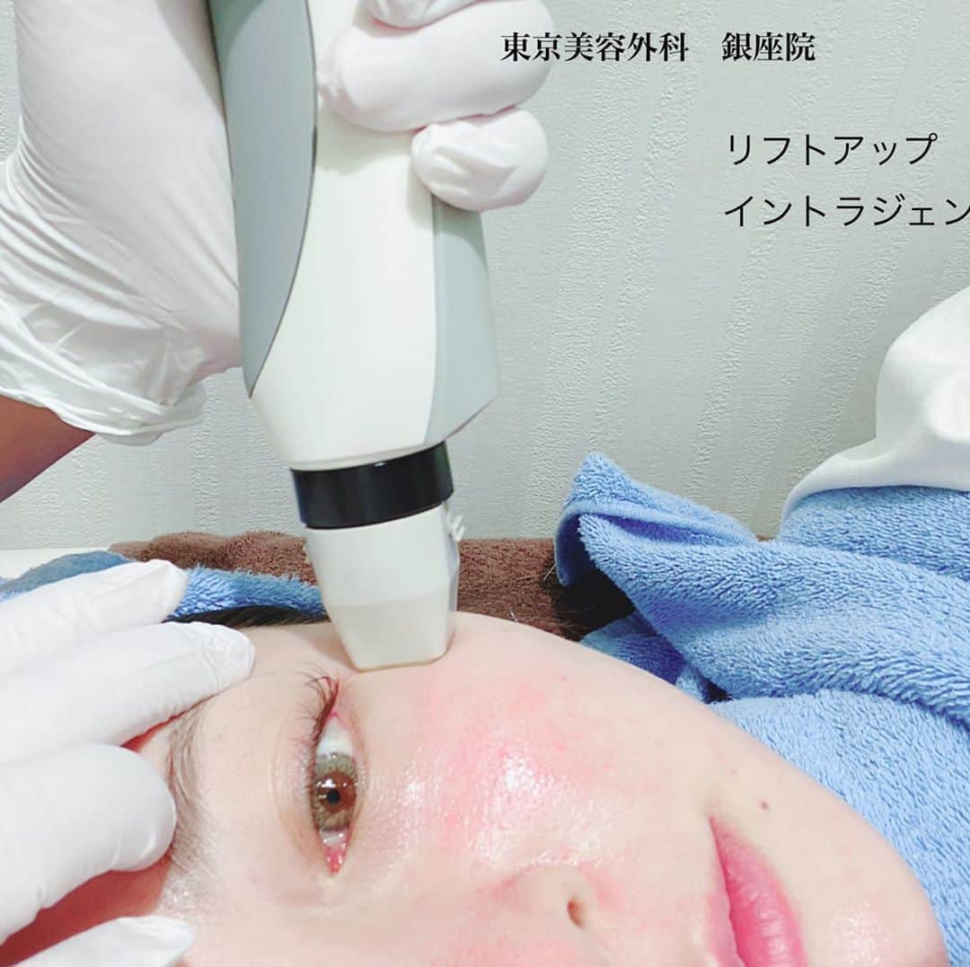 東京美容外科公式さんのインスタグラム写真 - (東京美容外科公式Instagram)「こんにちは🌞東京美容外科銀座院です🍍 本日ご紹介は　イントラジェン たるみリフトアップレーザーです✨メスを使わずに効果的にたるみを解消できます。 RF（高周波）を照射することでコラーゲンの再生を促し、肌内部から引き締め、痛みも少なくリフトアップ効果もあります。 痛みが怖くて今まで　勇気が出なかった方😊❣️❣️オススメです❣️❣️✨即効性も感じやすいですが　腫れや赤みもほぼ出ません✨ぜひお試しください✨✨  トライアルショット初回¥19800〜 . *･゜ﾟ･*:.｡..｡.:*'･*:.｡. .｡.:*･゜ﾟ･* 🐣東京美容外科銀座院 東京都中央区銀座7-9-11 モンブラン銀座ビル6F . ▼フリーダイヤル﻿ 0120-658-958﻿ (ｺｰﾙｾﾝﾀｰ受付時間：9：00～21：00）﻿ ▼LINE予約﻿ @ tkc110﻿ *･゜ﾟ･*:.｡..｡.:*'･*:.｡. .｡.:*･゜ﾟ･* . #東京美容外科#銀座院#東美 #美容外科#整形#老け顔#アンチエイジング#小顔#美容#美容女子#美容男子#美容好きな人と繋がりたい#整形 #イントラジェン#エラボト#ボトックス#銀座院限定#リフトアップ#クイーンリフト#ショッピングリフト#オルチャンリフト#たるみ#リフトアップ#糸リフト#銀座#新宿#赤坂」8月25日 16時22分 - tokyobiyougeka_jimukyoku