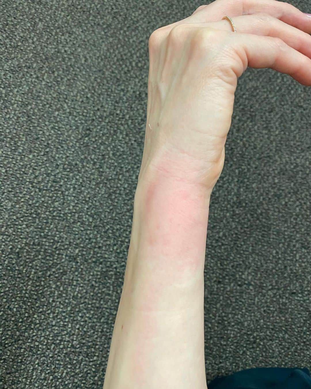 田中雅美さんのインスタグラム写真 - (田中雅美Instagram)「虫刺され〜。 腫れた〜。 痛い〜。  ・ ・ 夏の終わりの蚊は本当に嫌い。 まぁでも、子供が刺されなくてよかった。  ・ ・ #虫刺され #夏の終わりの蚊 #嫌い #強すぎ #痛い #腫れてる #保育園の帰り道」8月26日 5時49分 - tanakamasami_official
