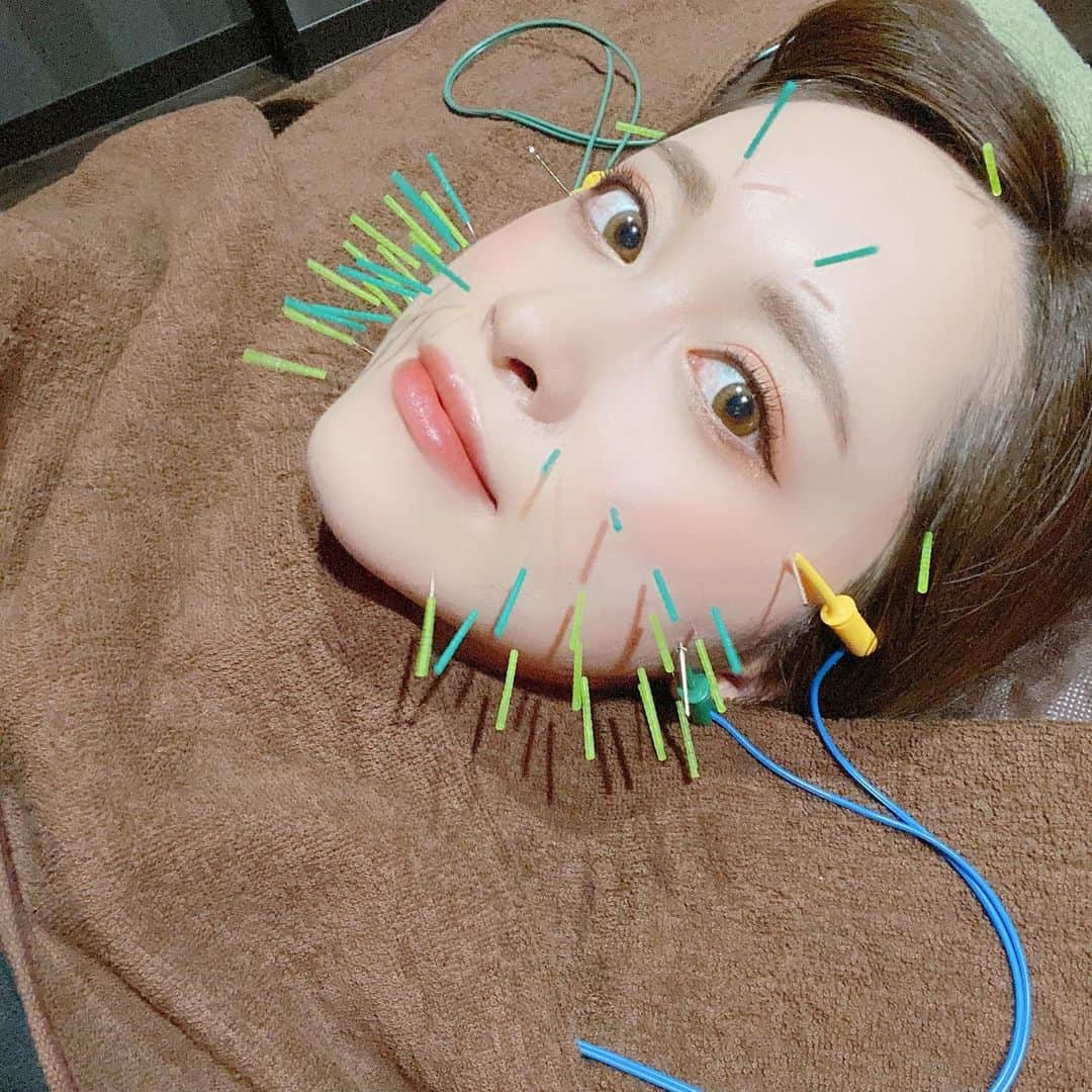 のインスタグラム：「✿  鍼〜！今回も癒された…スッキリした…🌸 肩首背中もやってもらって驚くほど軽くなったし 私肩揉まれたり触られたりするだけで くすぐったくて酷いとつるんだけど 施術後は揉まれても全然平気だったの…ほんと凄い…  多分私のインスタって男性の方が 見てる数は多いよねって思うし、 美容のことあんまり興味無い…って なる方もいるかもですが 普通に身体の不調で悩んでる方にも とってもオススメしたい…🌸 本当に本当に驚愕したから めちゃくちゃオススメする💪  すごく綺麗な場所だし( @b_carat.bykoritorinic ) 今だったら感染対策もすごくしっかりされてるし 杉崎先生もスタッフさんも優しいので 気になった方はぜひ是非～！  杉崎先生( @sugizakikenya )今回もありがとうございました！  #杉崎先生 #きゅきゅっと美容鍼 #白玉美乳鍼 #BCARAT式美容鍼 #BCARATbykoritorinic #BCARAT #Beauty #Body #Balance #笹塚 #笹塚美容鍼 #美容鍼 #美顔鍼」