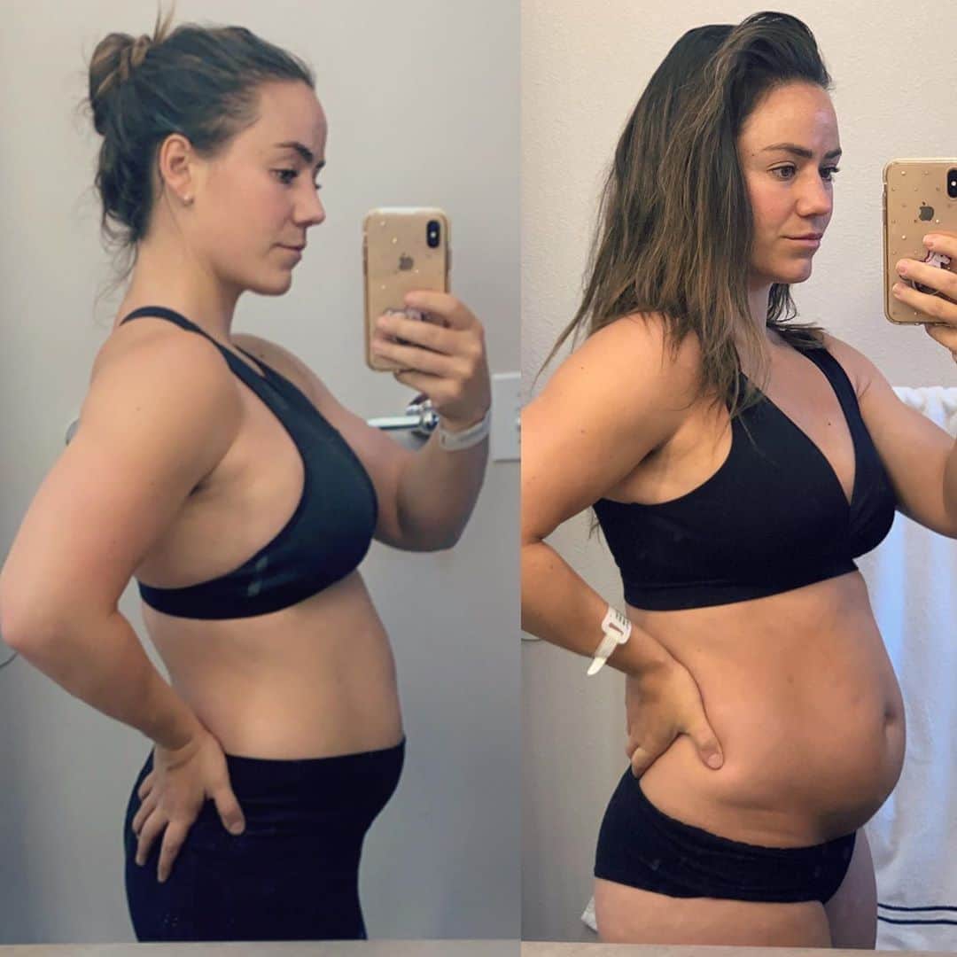 Camille Leblanc-Bazinetさんのインスタグラム写真 - (Camille Leblanc-BazinetInstagram)「6 weeks vs 4 weeks postpartum  149.6 lbs - 150.5lbs  “  Slow and steady is the name of the game! Even tho I am putting a lot of effort in my nutrition and training again, my weight didn’t move much wich can be frustrating. Now I know that this is a patience game and my hormones and body needs to adapt to everything so I am not worried. I started to weight and measure my food so I eat enough to maintain my milk production and really try to go for high quality food. Zoe is #1 priority.  Diet is higher and protein and I move everyday from walk to bike to some light lifting and rehabilitation for pelvic floor and trans abdominal.  Not gonna lie, I would love to see change faster but I know they will come. I also need to keep in mind that my main job right now is to produce good milk for Zoe and that I am still healing from the birth process   I can see my body is finally slowly changing and getting tighter, but I know this is going to take time and effort and I am all in for it 🤗🙌🏽 Healthy mama, health baby = happy family 🤗♥️   my point being : we must stop judging ourselves with the scale!  1-  are you fitter 2- does your clothes fit better 3- are your measurement better 4- are you a better person 5- do you like what you see in the mirror 6- do you like your life choices 7- are you comparing yourself to something achievable 8- are you healthier  9- is it healthy for you and the baby (that one is for me haha)   answering these questions are crucial in finding the right mindset and path in your fitness journey 🤗 also crucial in finding and sticking to a program   :)  even with my zero amount of sleep I can tell that my skin is so much better and the inflammation is coming down, I am also feeling stronger, fitter and its helping my mood, because lets me honest I might be the grumpiest person in the world with my husband these days #sofreakingtired  I will be doing the 30 days nutrition challenge starting august 31st! I can’t wait 🙌🏽  Link in bio to join me In our challenge eeekkk!!」8月26日 21時42分 - camillelbaz