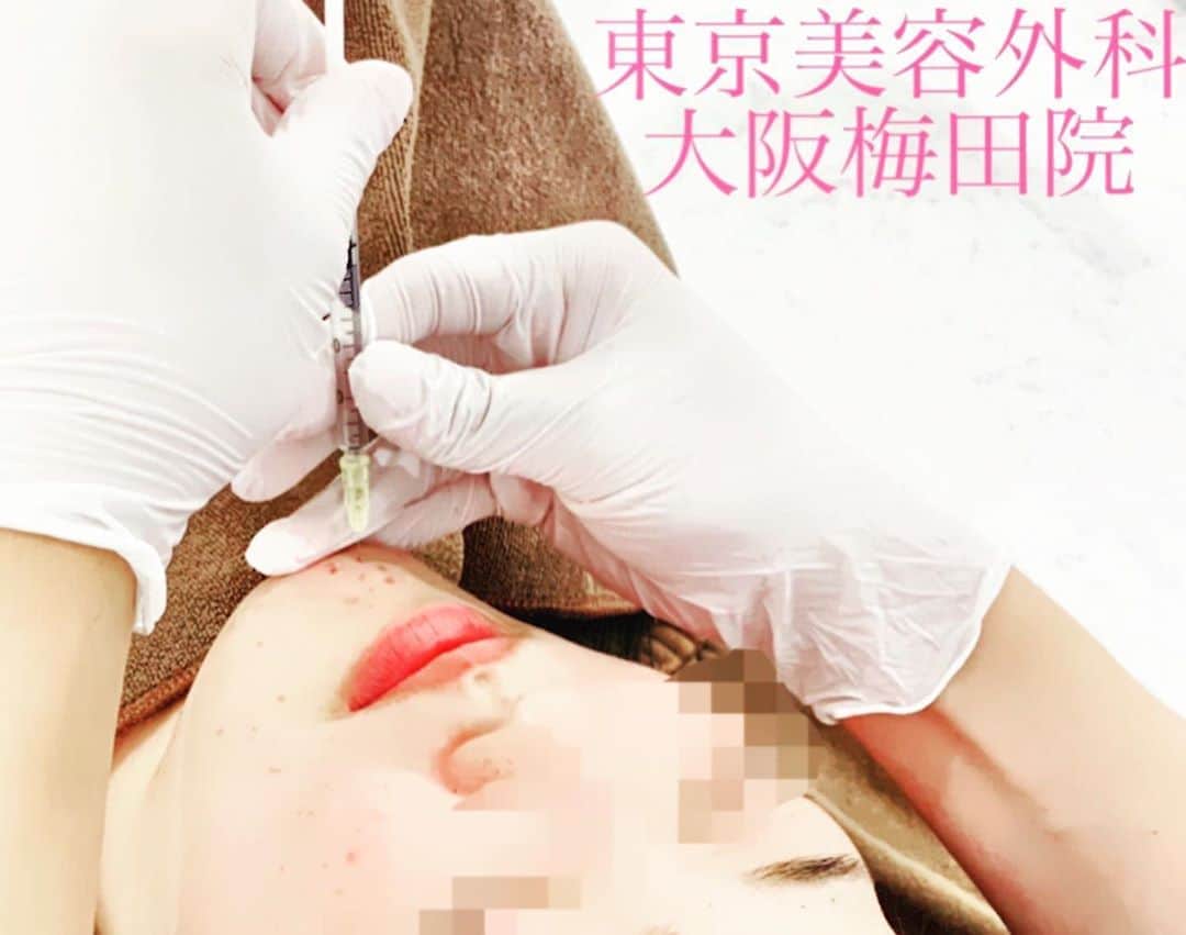 東京美容外科公式のインスタグラム