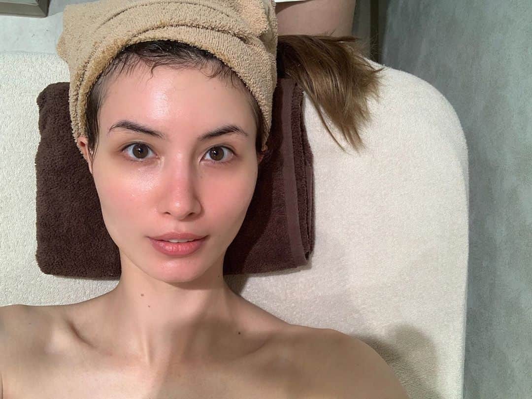 のインスタグラム：「. 念願のソニックフィット受けてきました！！！ 自分で色々と調べて、リリーオンっていうお店に行ってみました🥰 . 正直、こんなに効果をすぐ感じた施術は初めてかも....？？✨ 私の1番の悩み、顔の左右差がかなり整ったことがめちゃくちゃ嬉しくて🥺💕💕 . そして、私の骨格的に頬がこけやすいので、施術後に余計げっそりしないか心配だったんだけど、逆にこけてる部分はふっくらしてきますよって言われて えっ、いいとこしかなくない？ってなりました。笑 . 肌質も改善されていくみたいなので、最初は1ヶ月に1回くらい通って維持していってみようかなと思う〜〜🥰 . 写真は左側が施術後で、右側が施術前なんだけど明らかに目の位置とか違うのわかる〜！？ 小鼻もきゅっとなっておる。すごいぞ、ソニックフィット。 . #ソニックフィット#リリーオン#エステ#美容day#小顔エステ#毛穴ケア#リフトアップ#ママ美容」