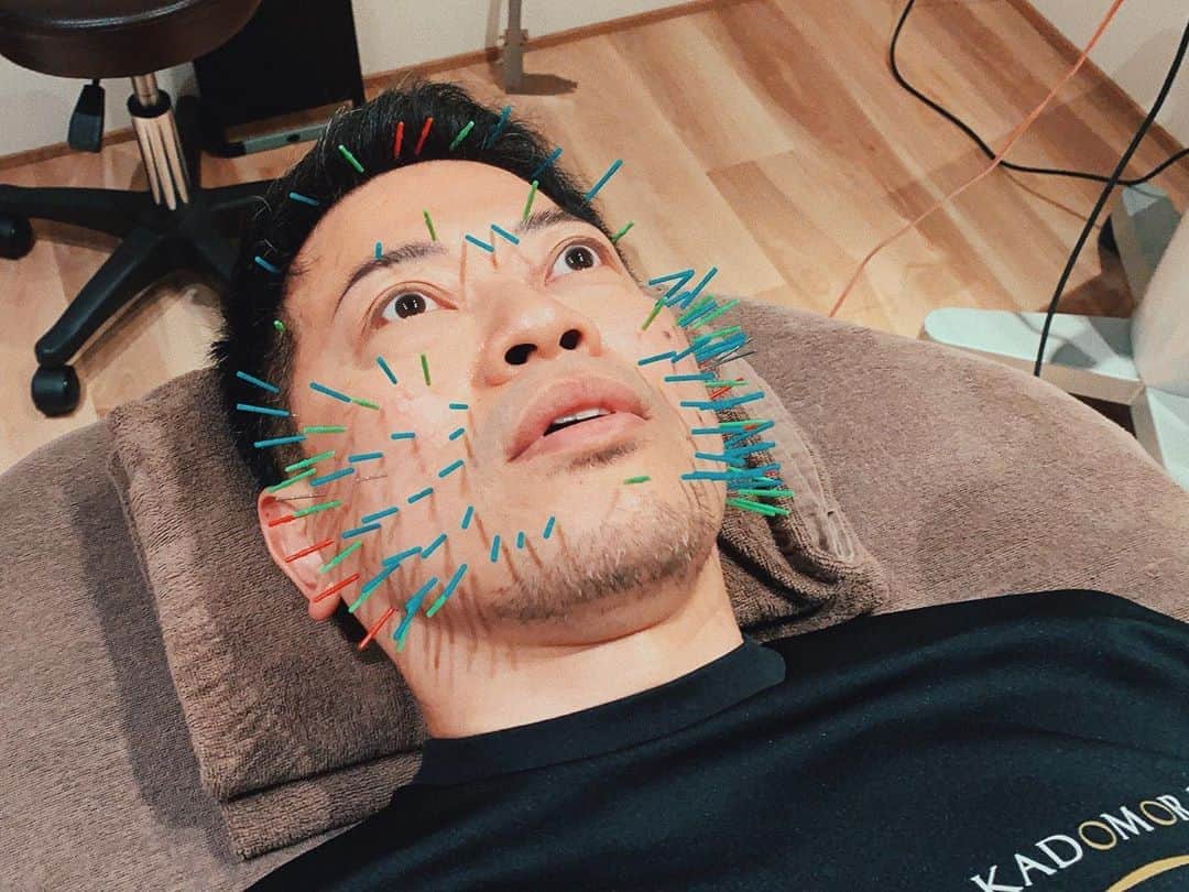 のインスタグラム：「昨日の動画、見てね〜！ 針、めちゃくちゃ怖かったけど、思ったより痛くはなかった。 めちゃくちゃ怖かったけどな！！！ . . . 写真：アヤト(@ayato_nishikido ) . #宮迫です #宮迫博之 #芸人 #お笑い #針 #ハリネズミ #カドモリ #小顔マッサージ #小顔矯正 #youtube #youtuber #撮影 #ポートレート #portrait #tokyo #japan #japaneseboy #japanese #instagram #instalike #instagood #good_portraits_world」