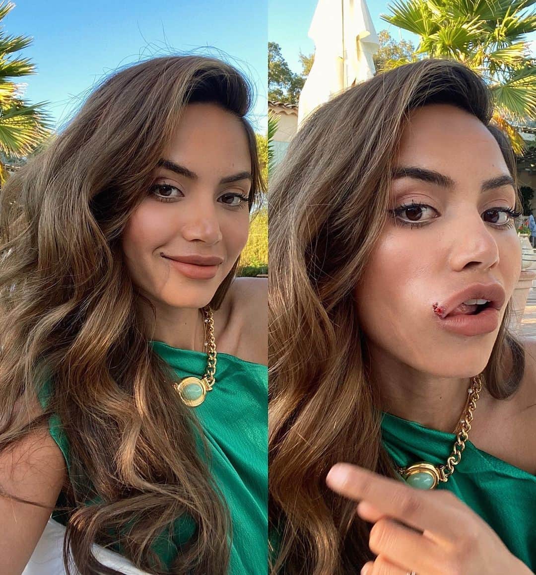 Diipa Büller-Khoslaのインスタグラム：「Here is my latest #RealOverPerfect moment:  When a few months ago @vogueindia India asked me to present the prestigious annual Beauty Awards, I was over the moon for the honour of being their host. But then what happens 2 days before the big day? This annoying, painful and ugly cold sore appears. I had no choice but to own it and do the entire event with it.   Comment below if you too know the frustration of getting a pimple, rash or cold sore just before a momentous event, presentation, job interview, or date?」