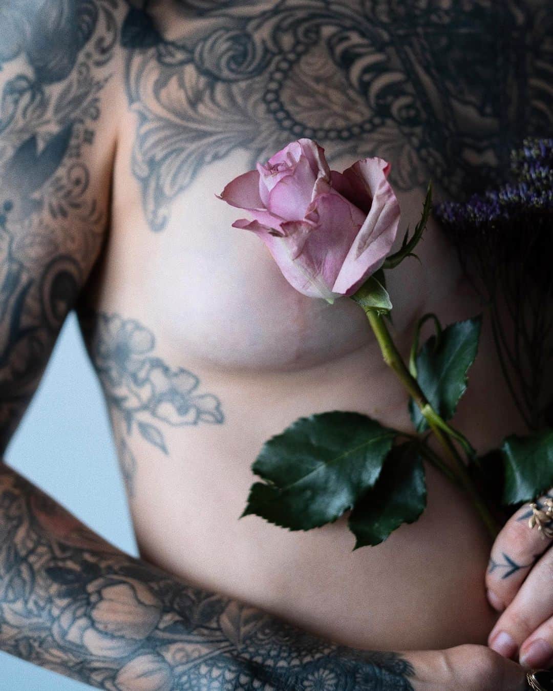 サラ・Xのインスタグラム：「Four years ago today I was laid open on an operating table and I had my breast implants + extra skin removed via #explant surgery.   It is DESPITE having implants that I am where I am today - I actually make MORE money doing what I do now than I ever did when I had implants & having them only ever made my life miserable, in multiple ways.  My health began to deteriorate almost as soon as I got them “installed”, but it took almost six years to connect my health issues with my implants (most of which improved or disappeared after #explantsurgery).  For me, having implants had a lot of other unintended consequences. I quickly discovered that I couldn’t ever escape being constantly sexualized, both in public & online.   I tried to make the best of it, which eventually included making a video that I just thought was funny and a bit cheeky, but it went viral and I ended up with an audience of many disgusting m*n I did not want, who I am trying to this day to be completely rid of.  I also ended up with management that pushed me to make more “s*xy” content. I remember going into meetings so excited, asking for support and guidance on how to get into making other types of content that interested me, such as beauty or fashion, being dismissed entirely, told to keep doing what I was doing because it was “working” (for them). At a certain point I had to just keep doing it because that had become my job & the box I was put into. I'm incredibly glad I was able to find my way out - explanting helped A LOT.  There are two positives that came of the whole experience: trying to figure out how to get to where I wanted to be from where I found myself led me to studying social media, which led me to a career working in social media for other people. Because I had a larger audience, I have also been able to continue to spread the word about #breastimplantillness & reach many other women looking for answers like I once was.  My first post on my feed here is me waking up from surgery, and you can see the relief. I am SO much happier & healthier.   People often ask me, even 4 years later, don’t you miss them?  My answer is, without hesitation, ABSOLUTELY NOT.」