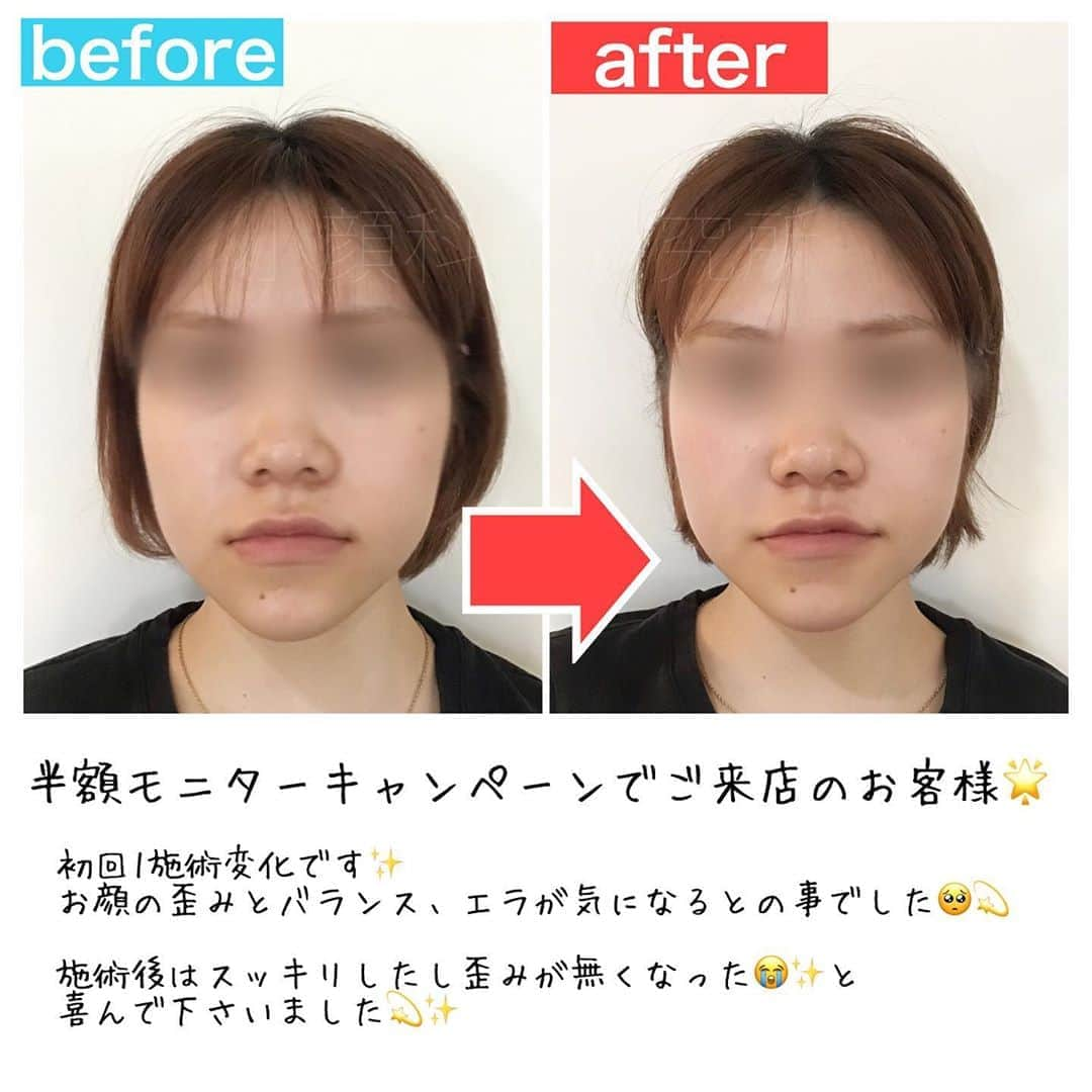 小顔科学研究所 のインスタグラム