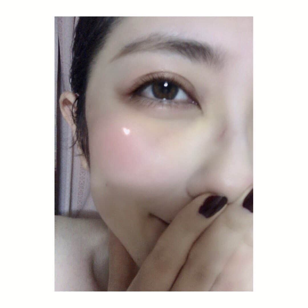 ゆりあさんのインスタグラム写真 - (ゆりあInstagram)「. . . . 殴られたんとちゃいますよ？w . . . . 途中経過です♡ 腫れが引いてきて、 あざが黄色くなりました‼︎ . . . . 涙袋は涙袋で残ってた♫ . . . その下のたるみが綺麗になったよ♡ . . . 裸眼もありかな？ 裸眼の方が韓国ぽいかもしれないw . . . #美容整形 #美容外科 #目の下の脂肪取り #クマ取り #クマ #たるみ #アンチエイジング #ヒアルロン酸 #二重 #くすみ #シミ  #미용성형 #성형외과 #쁘띠성형 #눈밑지방제거 #입술필러 #綺麗は作れる #努力は必ず報われる . . . .」9月3日 22時07分 - yuria_life