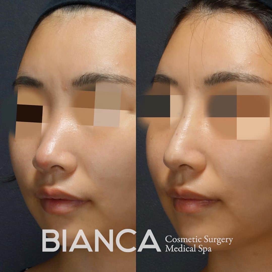辻沢由有（BIANCA CLNIC 表参道院 院長）のインスタグラム