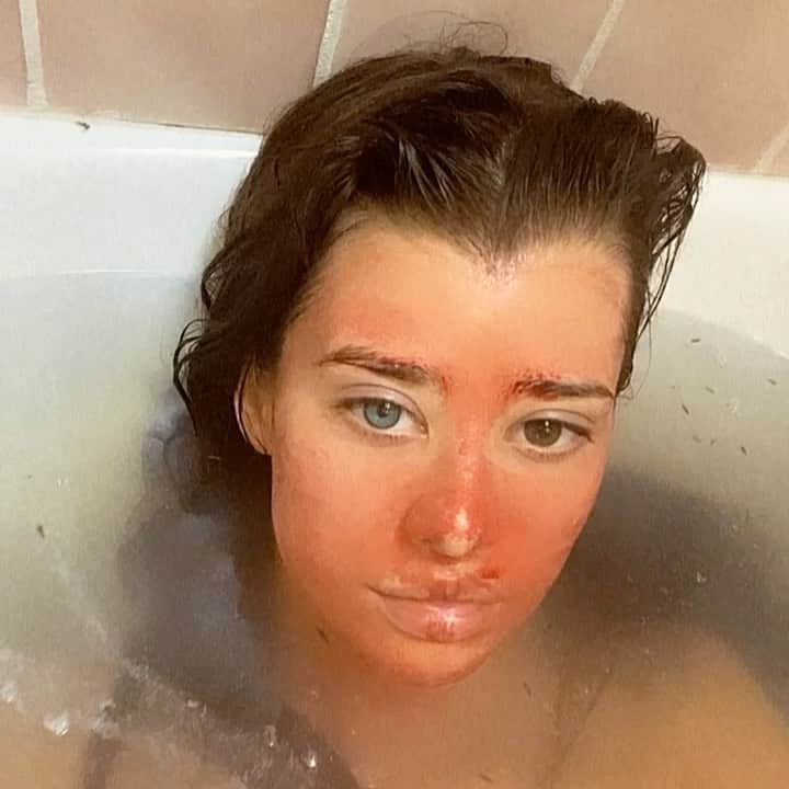 Sarahのインスタグラム：「Happy moon time:  Menstrual blood-derived stem cells (MenSCs) are a novel source of mesenchymal stem cells because the MenSCs are much more prolific than bone marrow cells with a 100,000x higher growth factor presumably due to the fact that it is the only tissue in the body that regenerates every month. Bone marrow stem cells have the potential to form 4% of cardiac stem cells while menstrual blood can form 25% cardiac cells.」