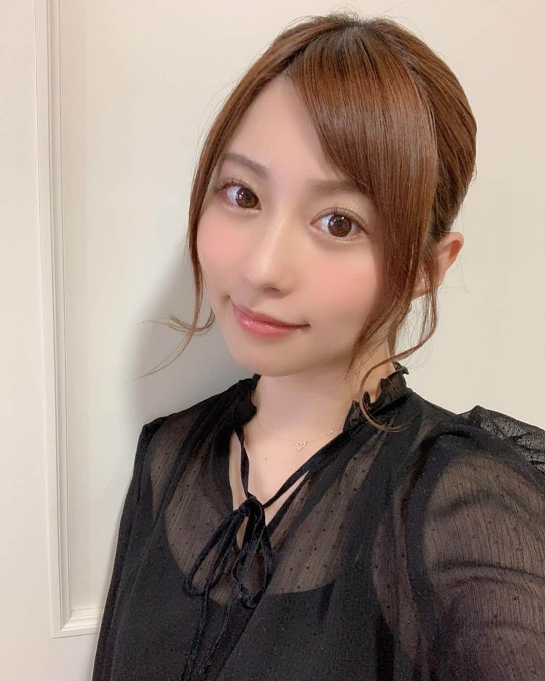 のインスタグラム：「🙌 . . 今日は1ヶ月に一度の 歯列矯正 ワイヤー交換の日✨ . . 先生に 「あとどのくらいの期間で 終わりますか？」 と 聞いてみたら . 思ったより早かった！ . もう終わりが見えているんだー！ って すごく嬉しくなりました😂！ . . 終わったら 色んなもの食べたり 沢山歌ったりして 過ごしたいなー✨ . . #歯列矯正」