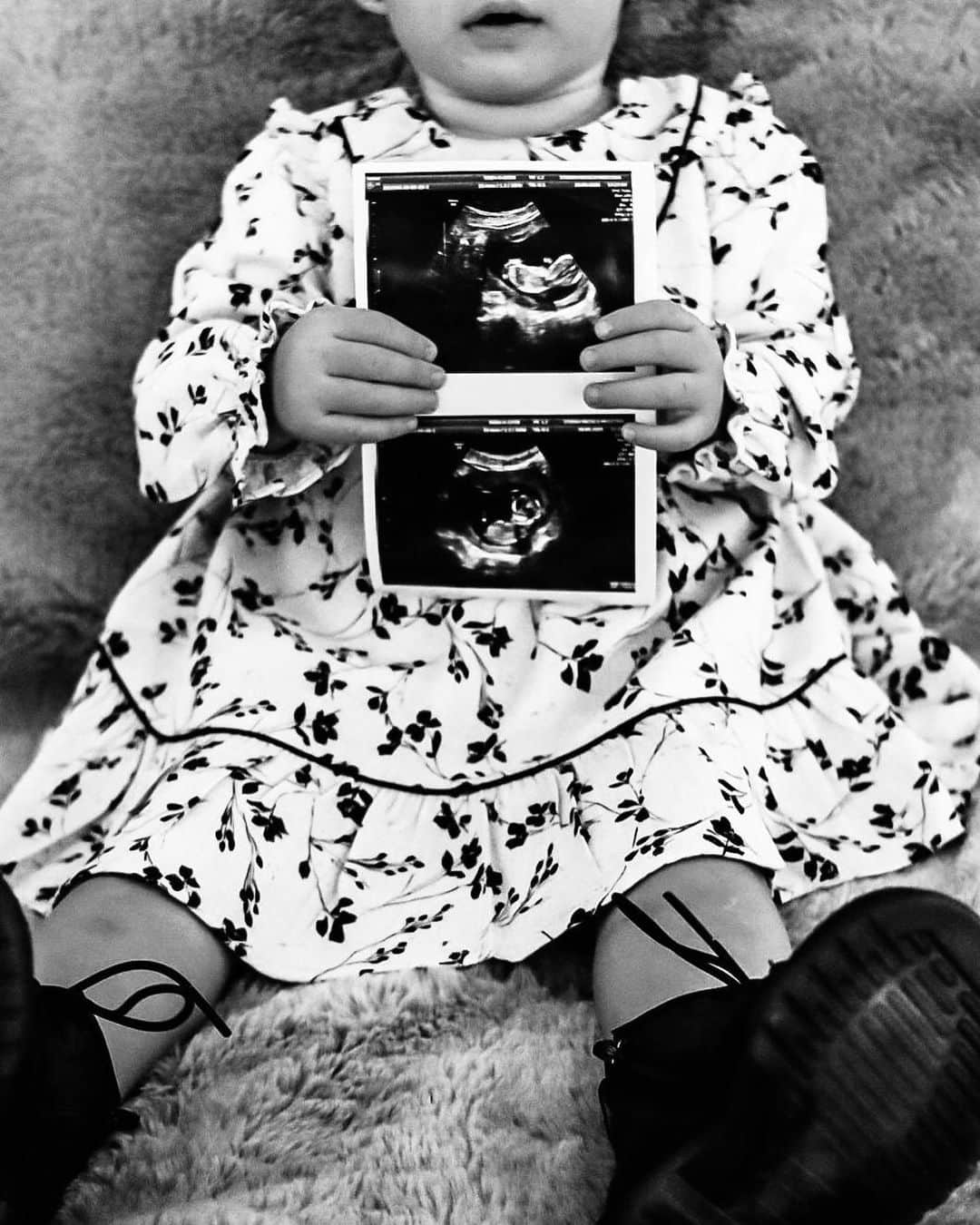 ハカン・チャルハノールのインスタグラム：「Ailemize küçük bir mucize daha geliyor. Liyamız abla oluyor. Sağlıklı gel bebeğim ❤️👼  ⁣⁣⁣⁣ Un altro miracolo si sta per realizzare nella nostra famiglia. Non vediamo l’ora di conoscerti ❤️👼 ⁣ ⁣ One more miracle is on its way for our family. Liya is becoming a sister. We can’t wait to meet you ❤️👼⁣ ⁣ 📸 @aylin_ckr」