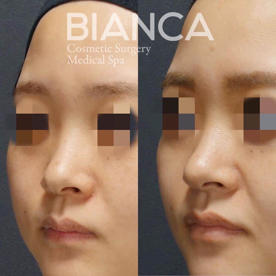 辻沢由有（BIANCA CLNIC 表参道院 院長）のインスタグラム