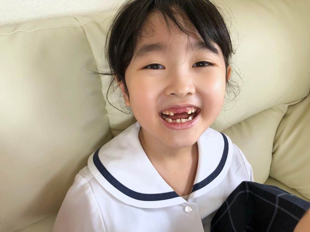 坂本竜介のインスタグラム：「前歯がなくなったドラキュラ化🧛‍♀️ #ドラキュラ #dracula  #daughter  #7歳 #7yearsold  #愛娘 #前歯 #小学生 #小1」