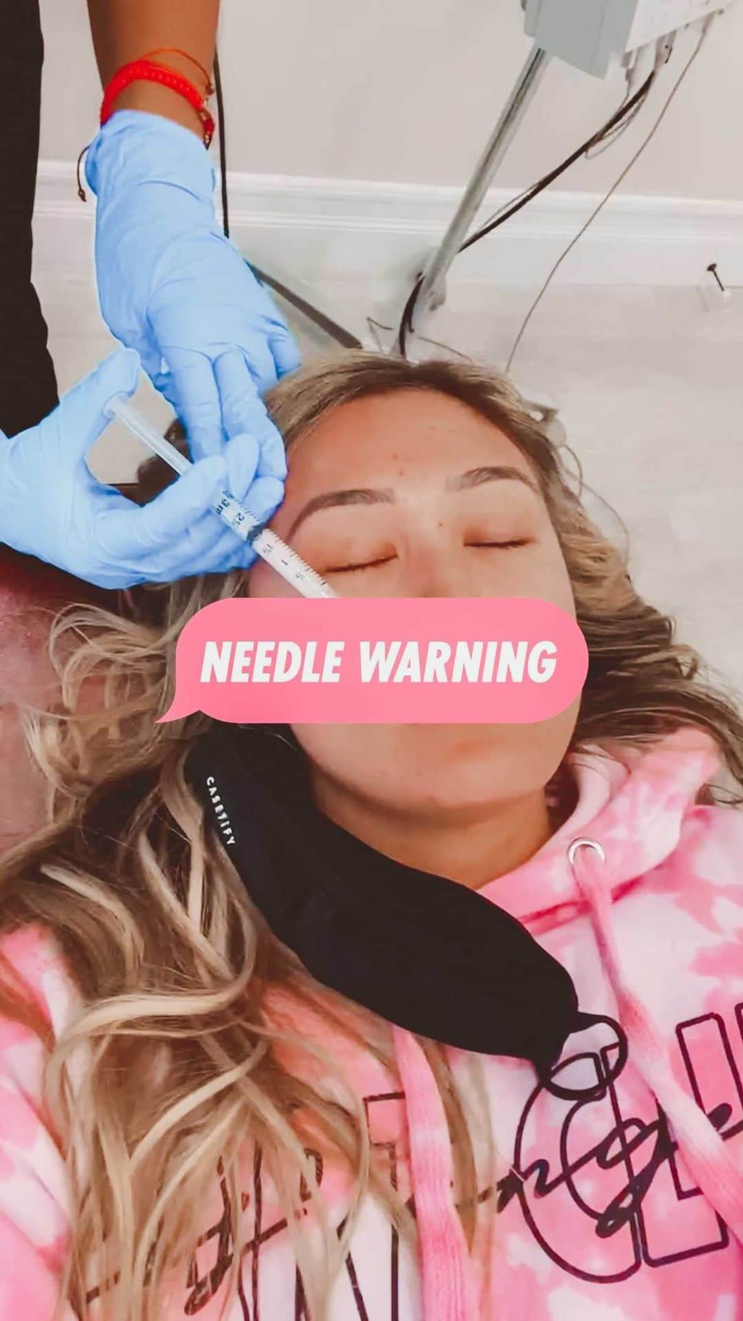 Lauren Riihimakiのインスタグラム：「A recap of my experience! Needle in face warning LOL. Make sure to talk to your doctor/dermatologist + do your research about the possible side effects before deciding if this is something you want to try!!」